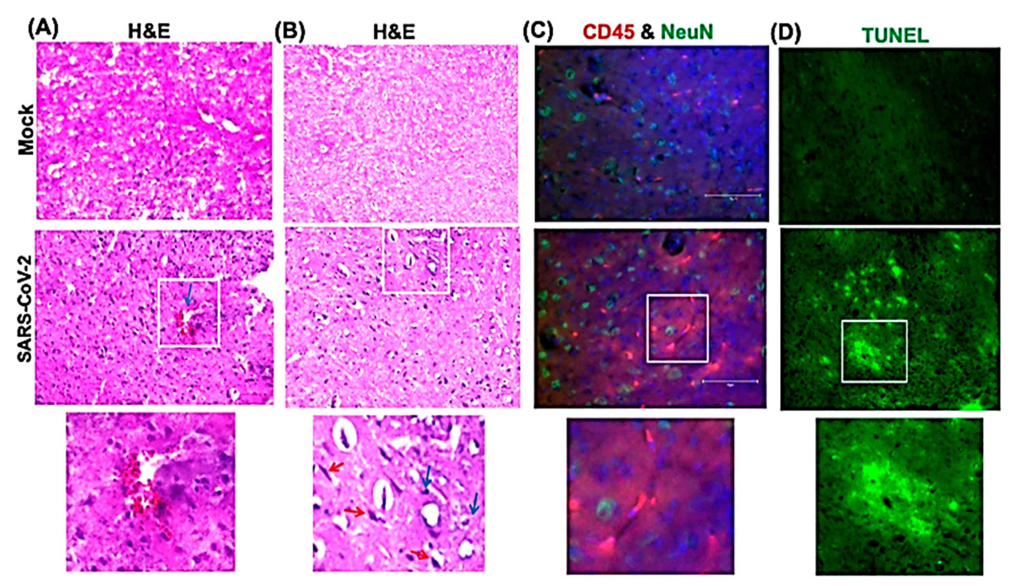 Viruses 13 00132 g006