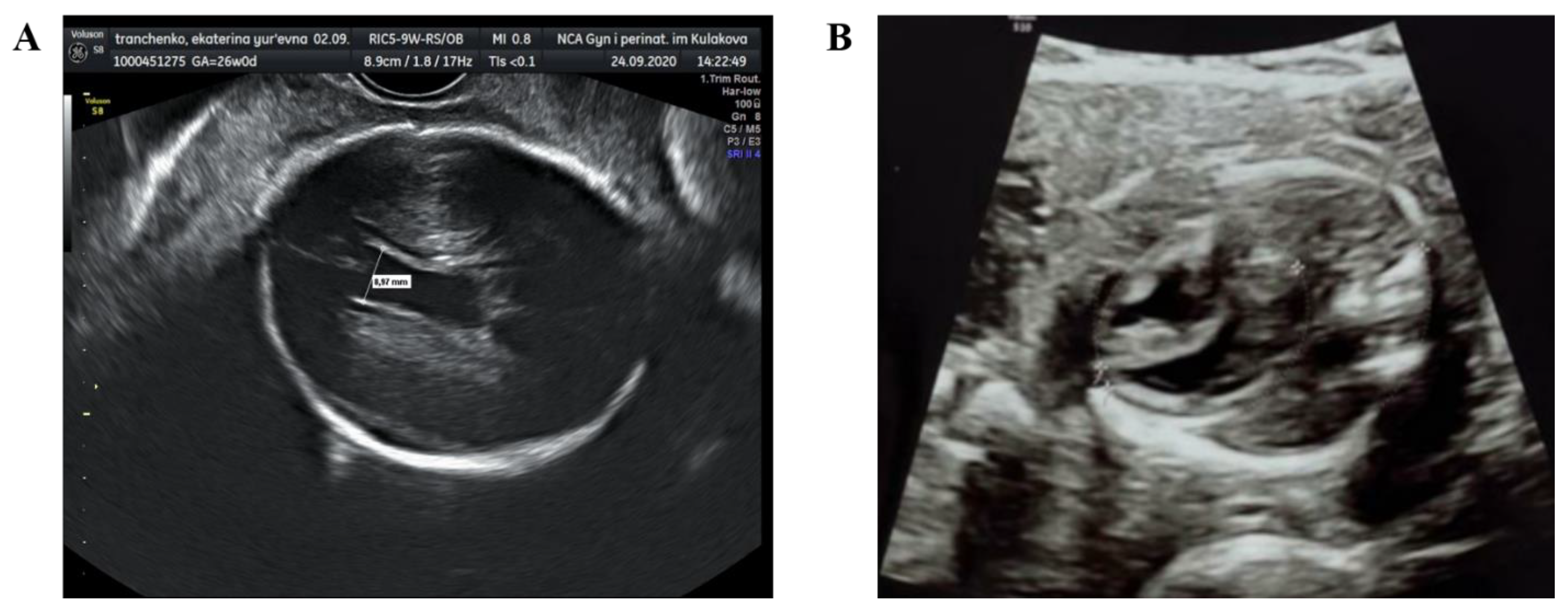 Viruses 13 00447 g001 Viruses 13 00447 g001