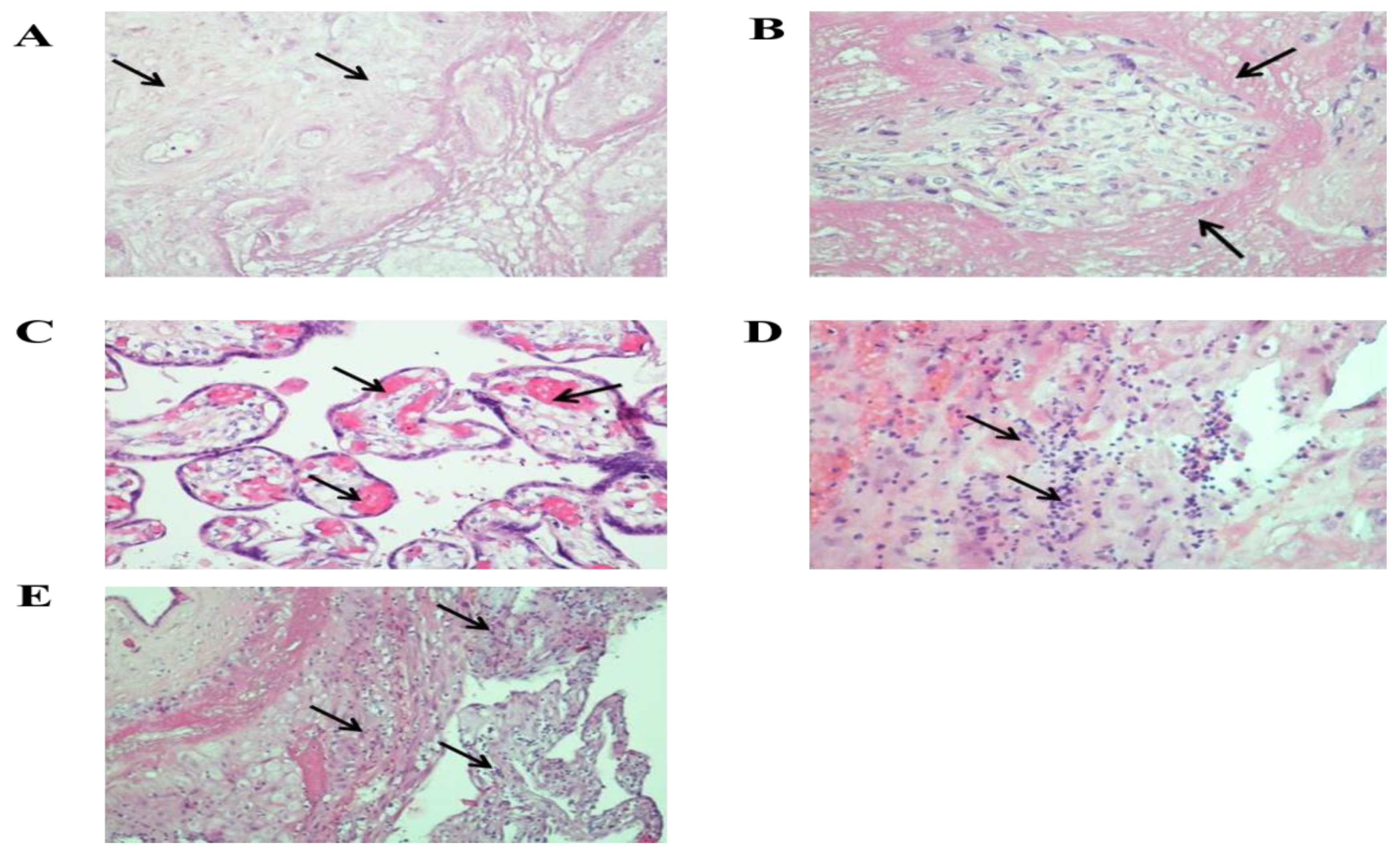 Viruses 13 00447 g002 Viruses 13 00447 g002