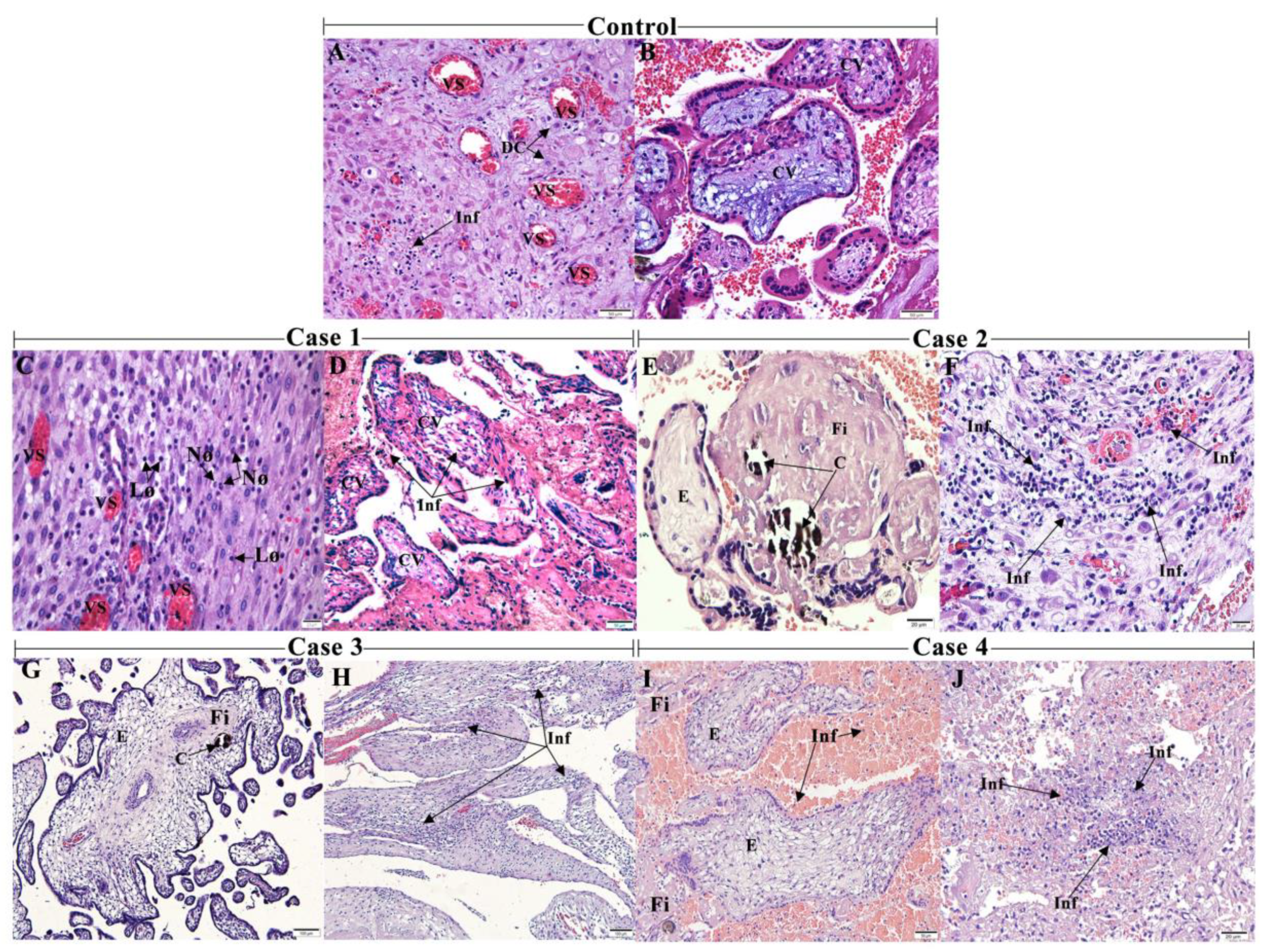 Viruses 13 00554 g001