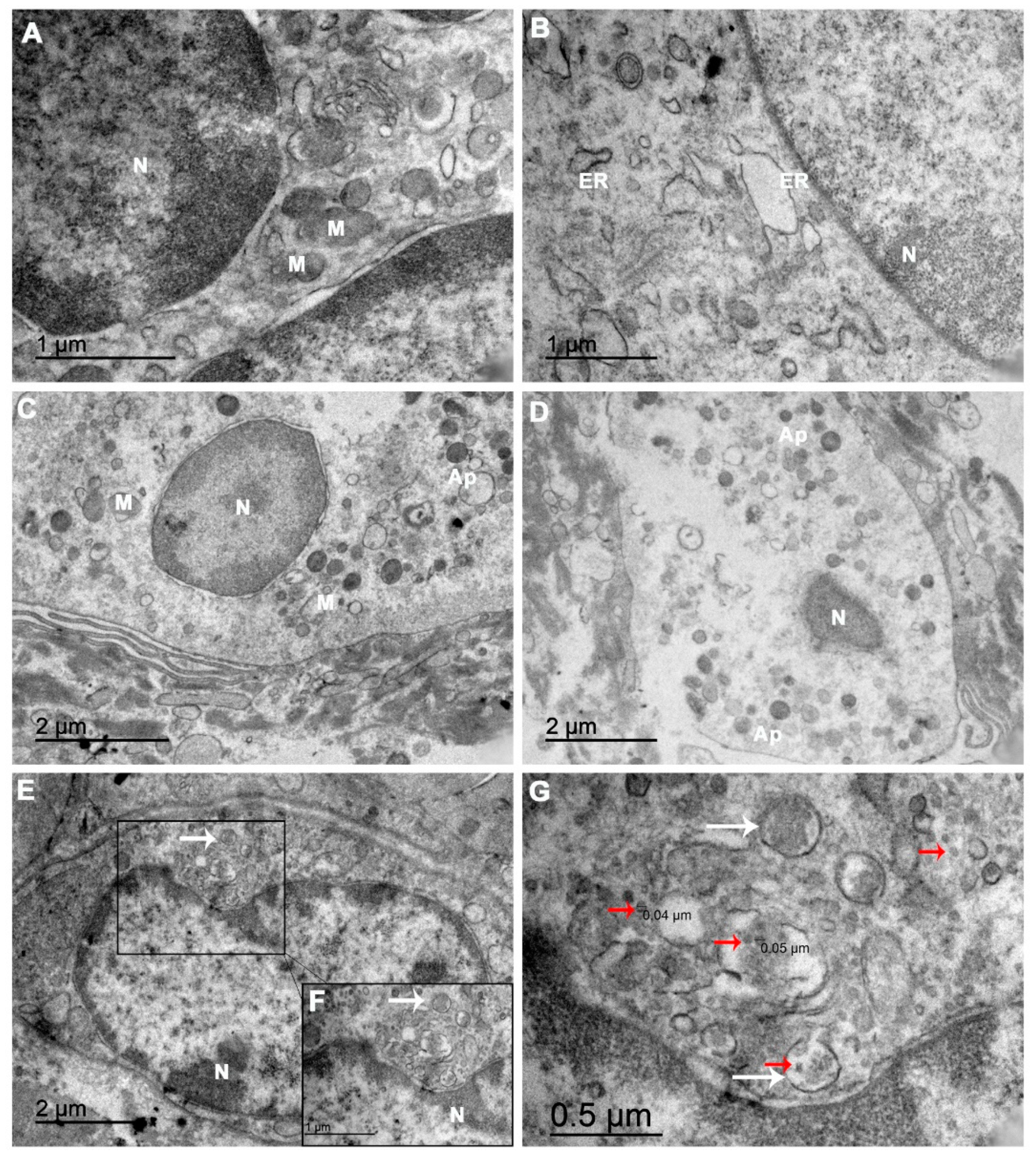 Viruses 13 00554 g004