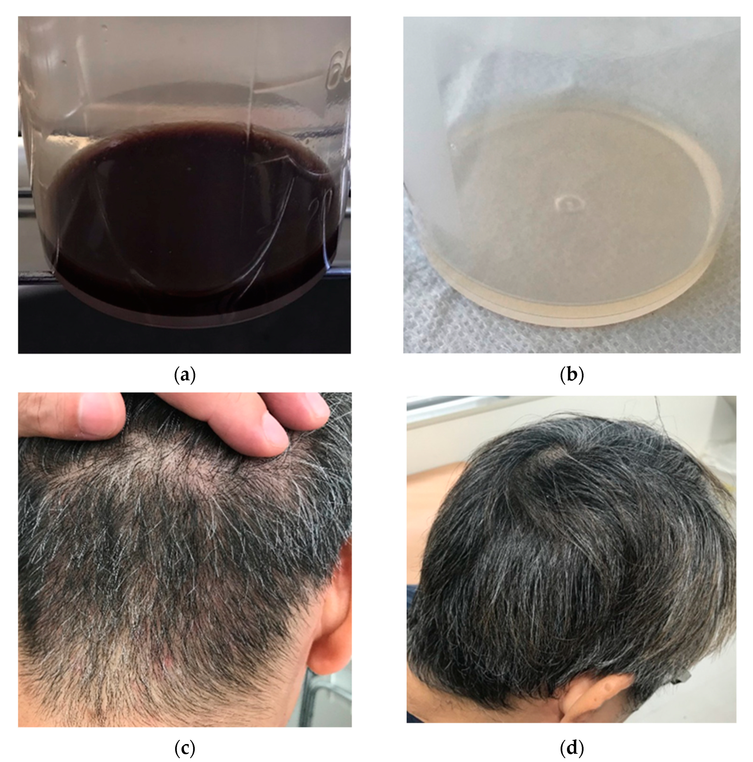 Viruses 13 00657 g001 Viruses 13 00657 g001