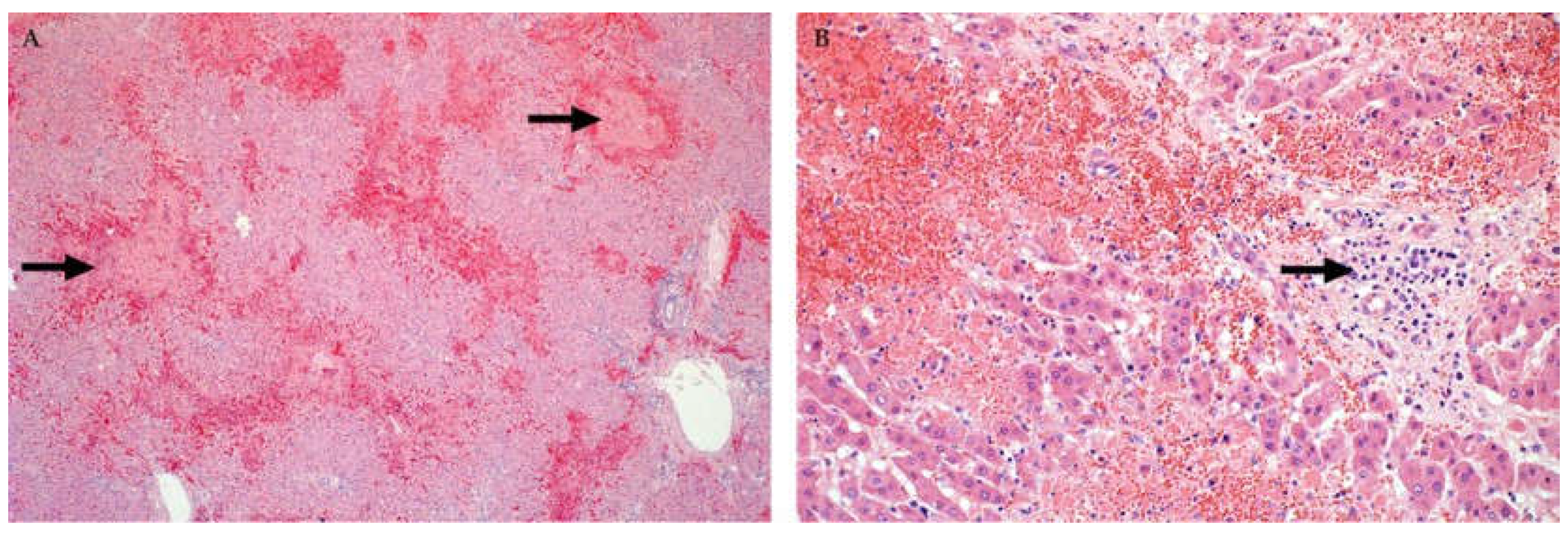 Viruses 13 00709 g002