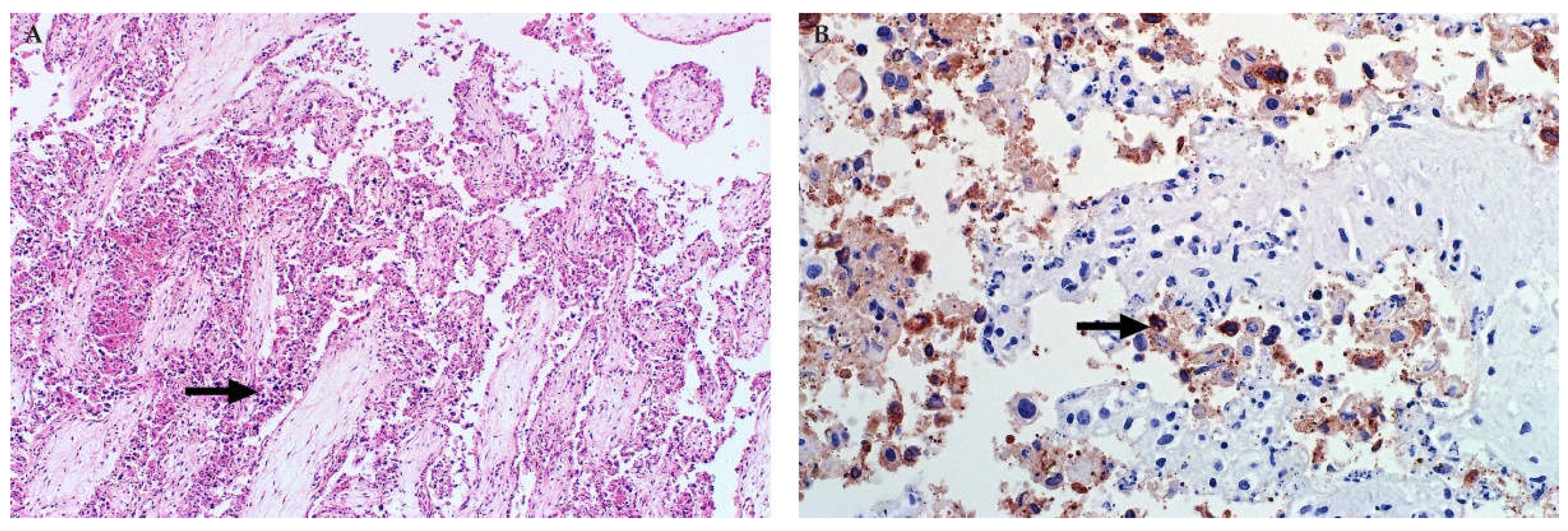 Viruses 13 00709 g015