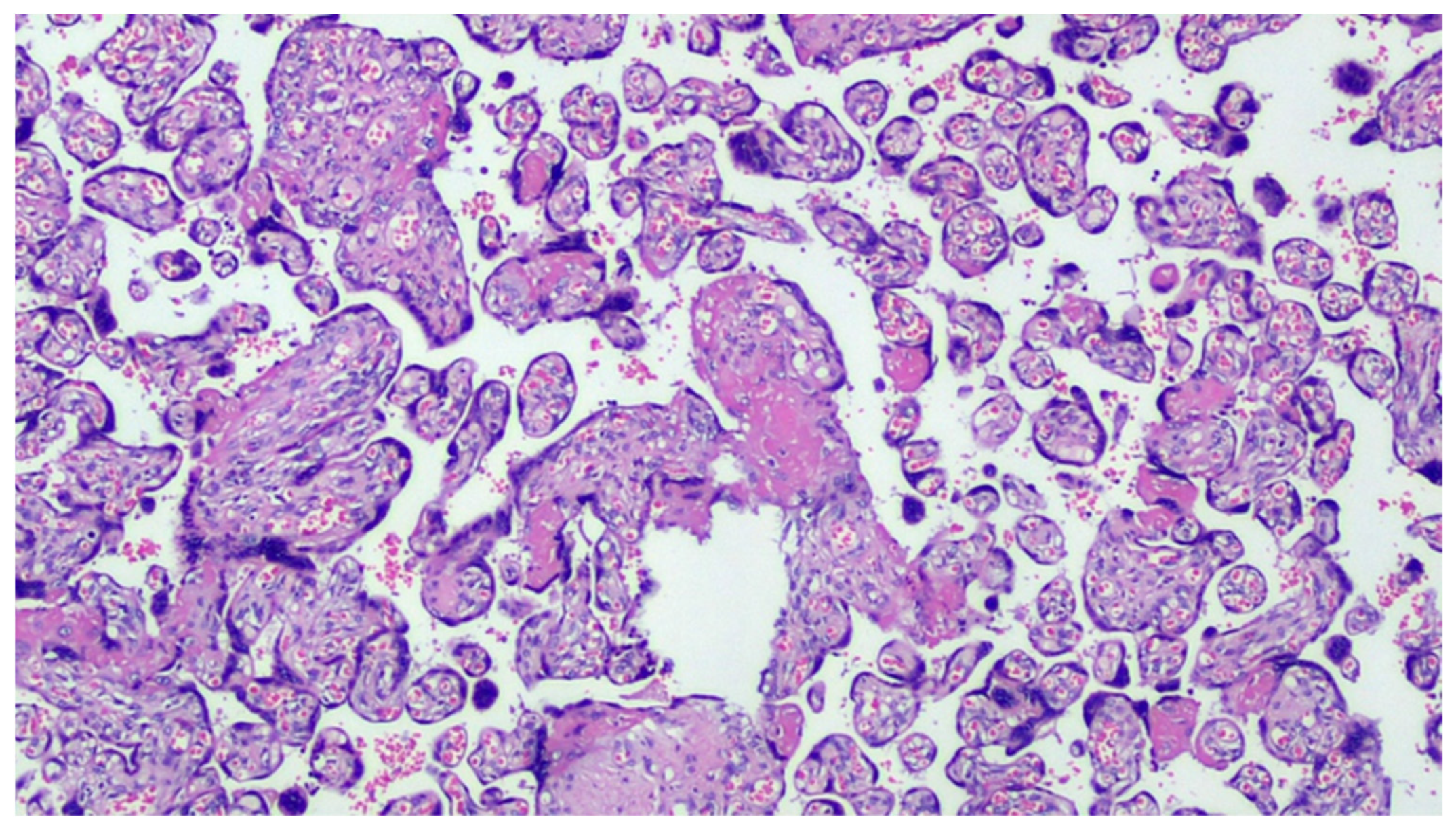 Viruses 13 00723 g001 Viruses 13 00723 g001