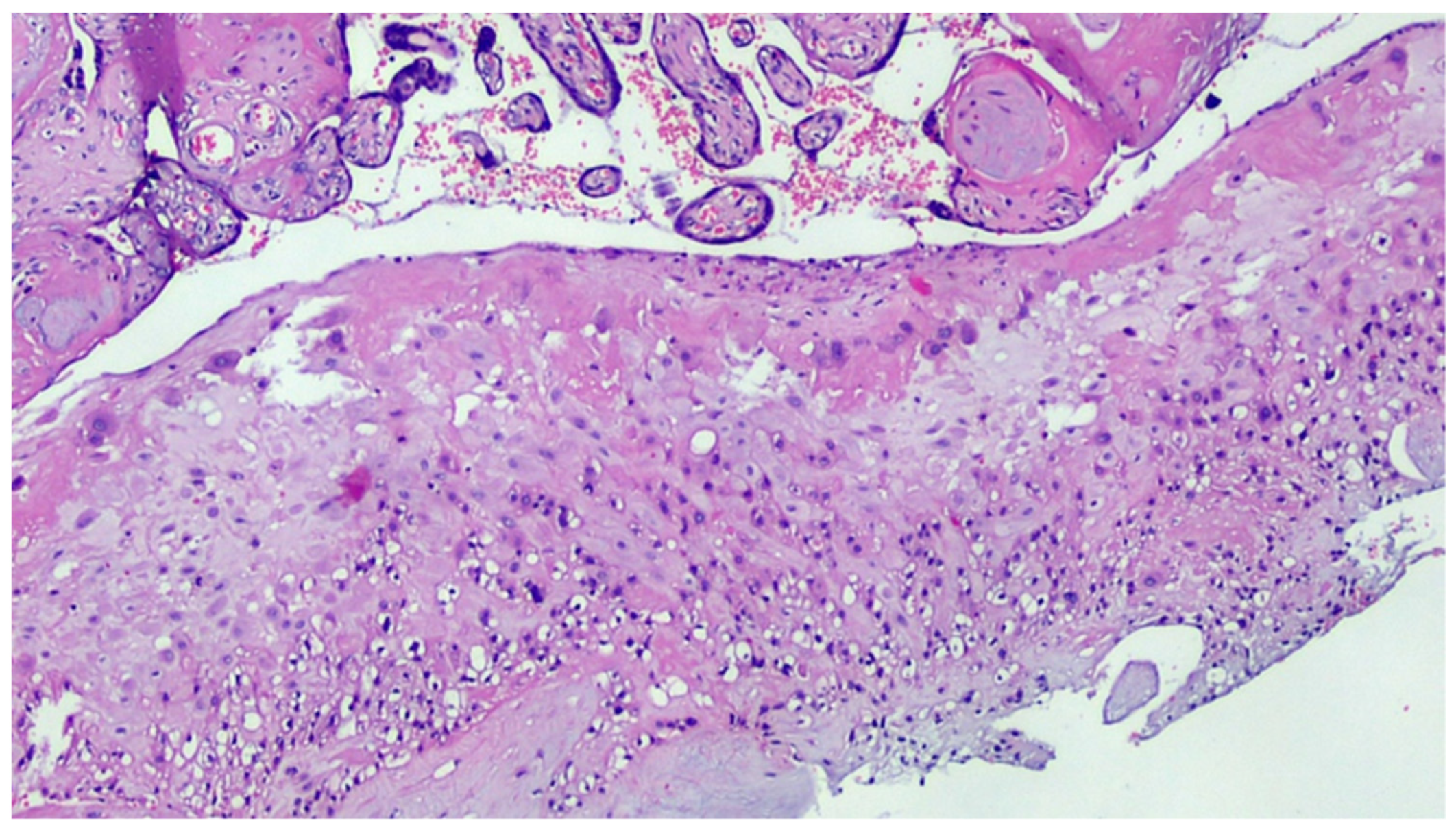 Viruses 13 00723 g003 Viruses 13 00723 g003