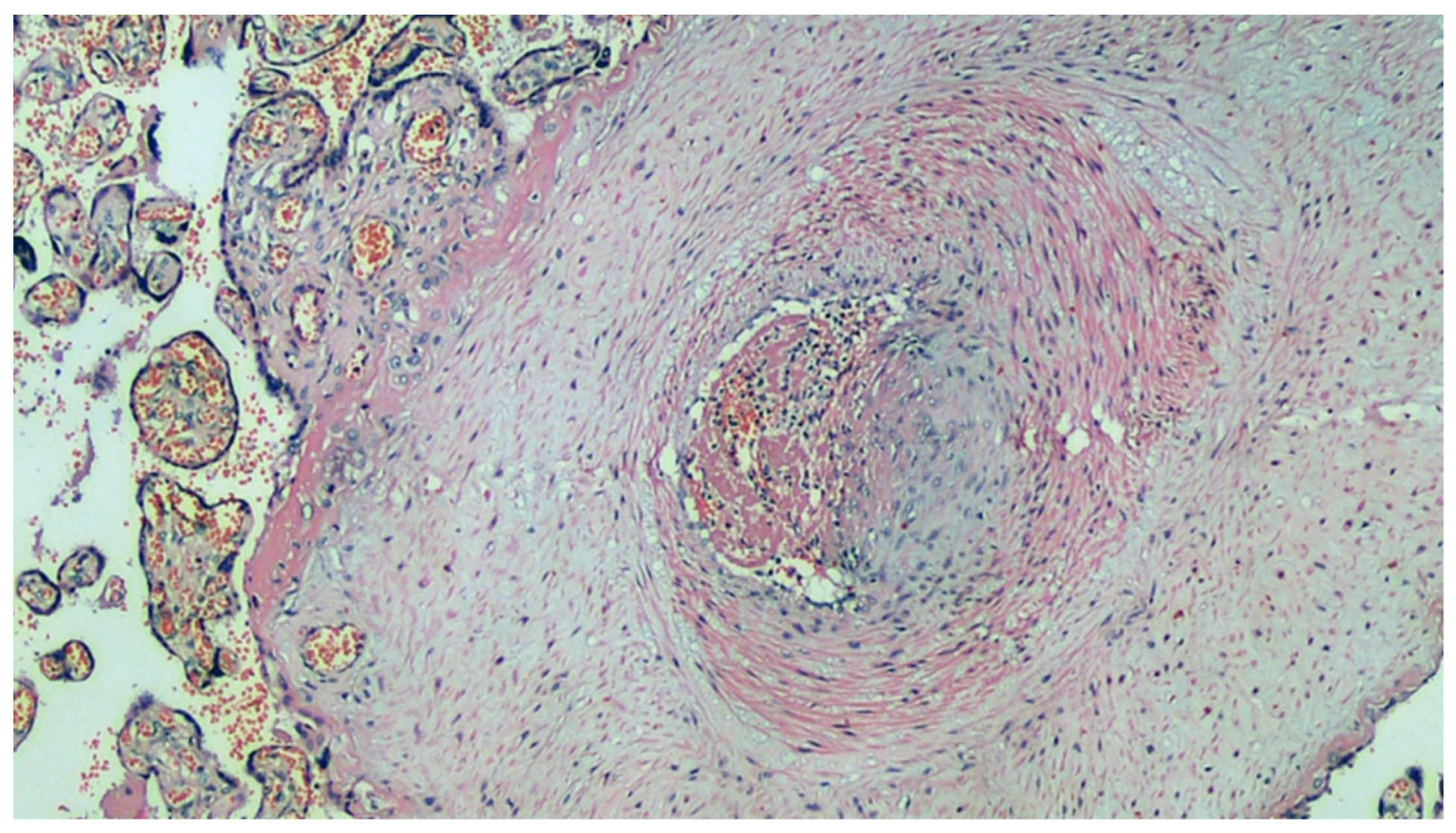 Viruses 13 00723 g005 Viruses 13 00723 g005