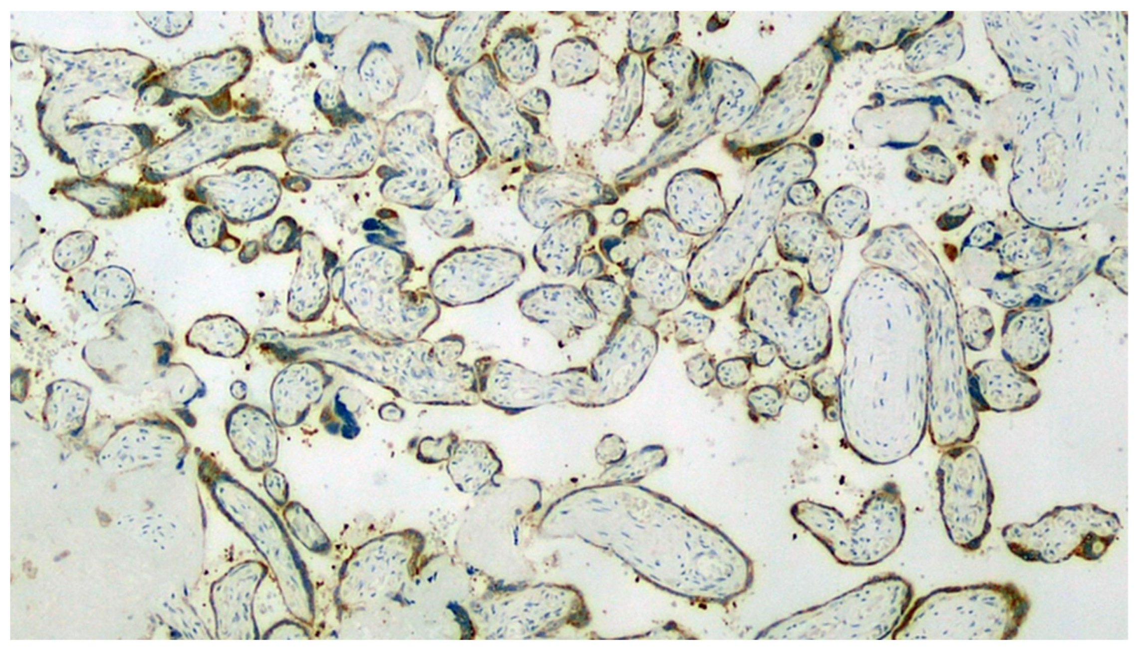 Viruses 13 00723 g006 Viruses 13 00723 g006