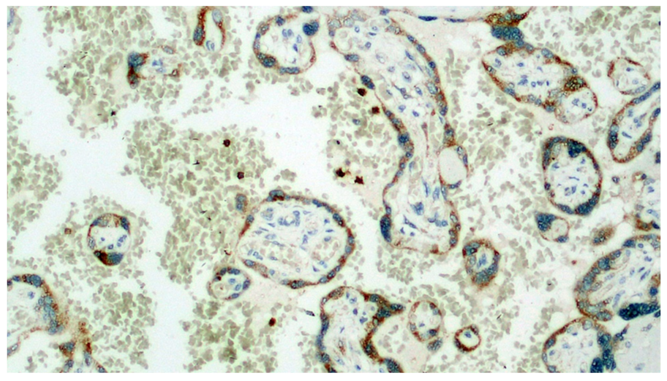 Viruses 13 00723 g007 Viruses 13 00723 g007