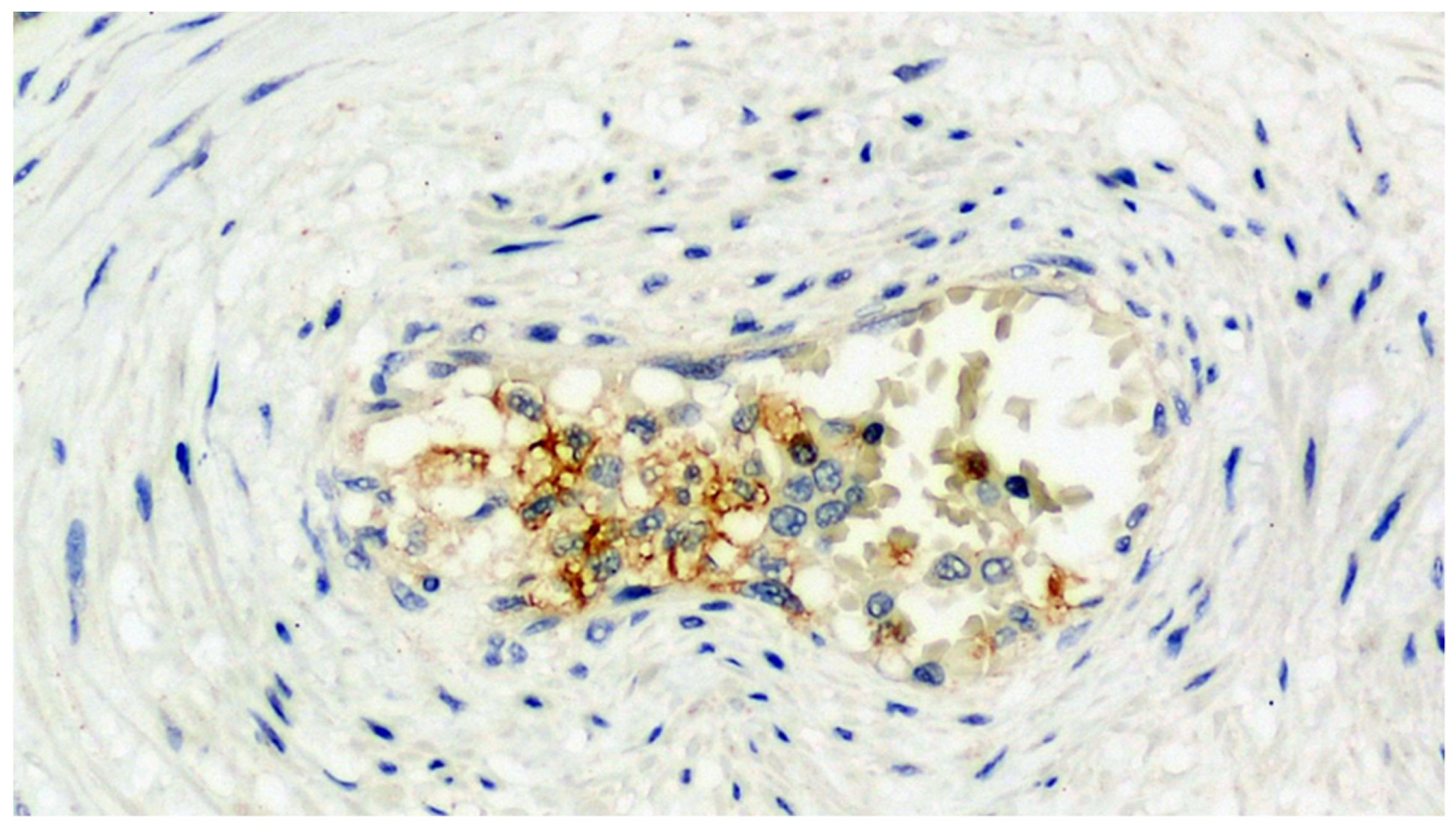 Viruses 13 00723 g009 Viruses 13 00723 g009