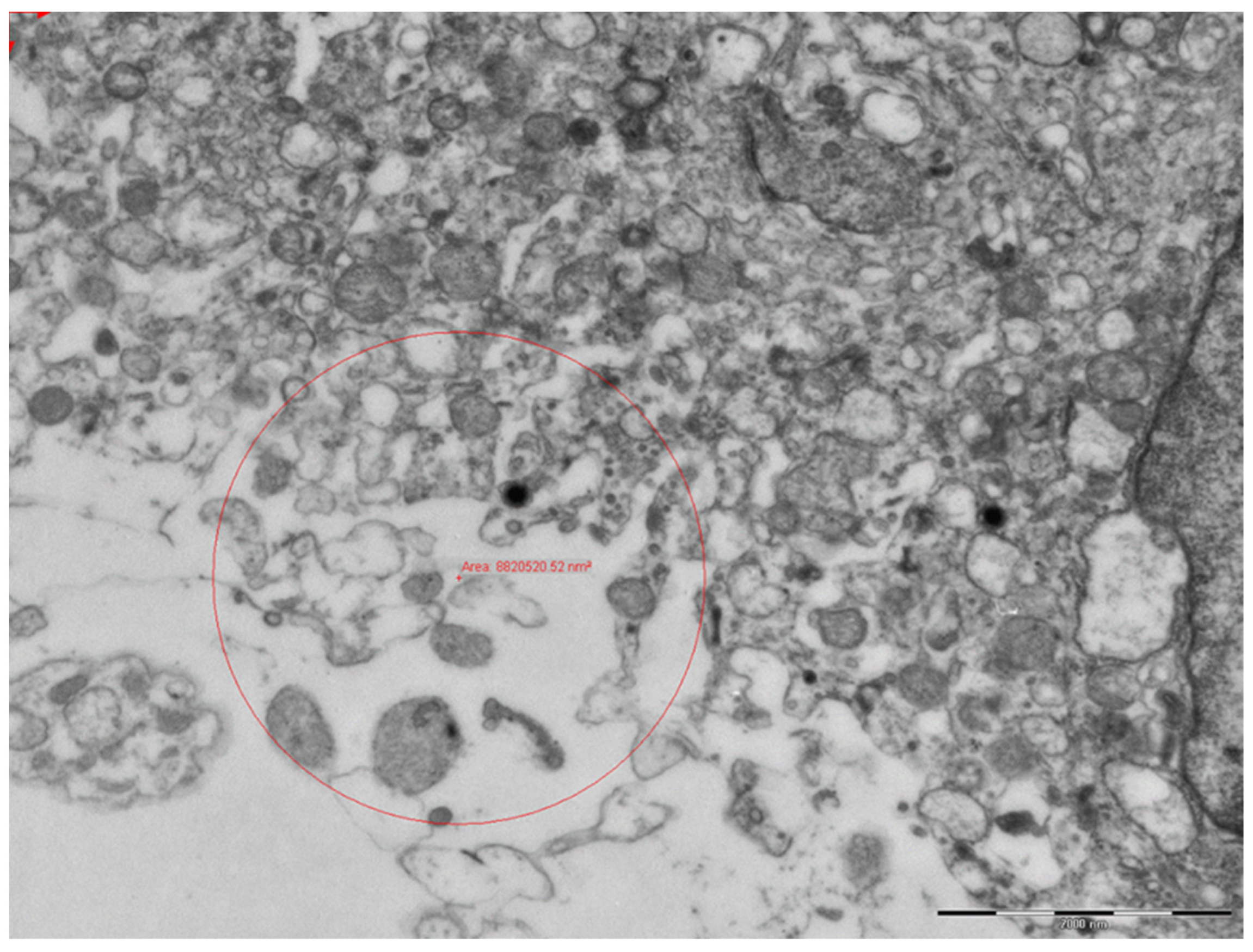 Viruses 13 00723 g010 Viruses 13 00723 g010