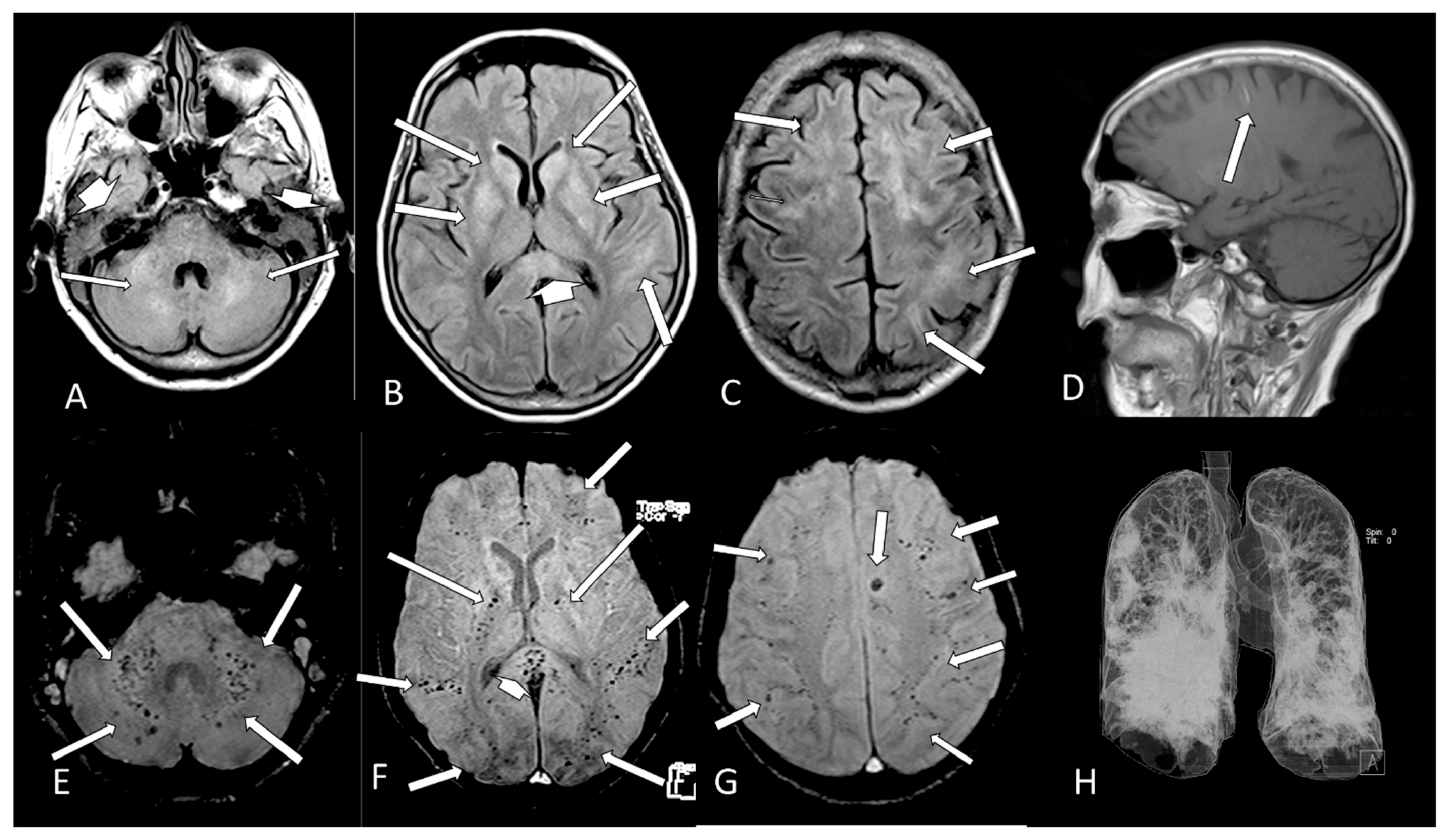 Viruses 13 00845 g005