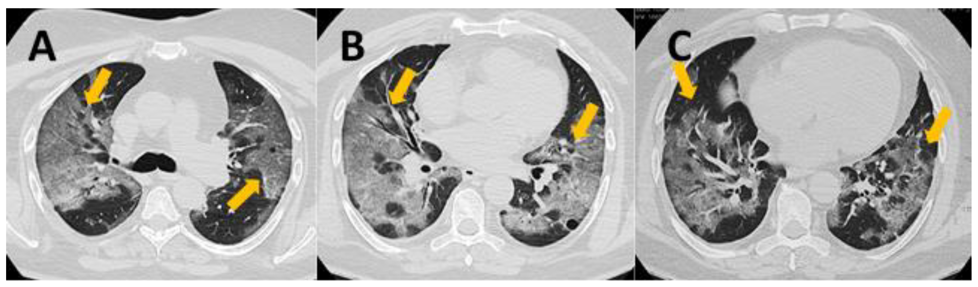 Viruses 13 00880 g0a1