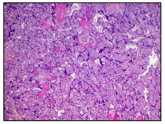 Viruses 13 00995 g001