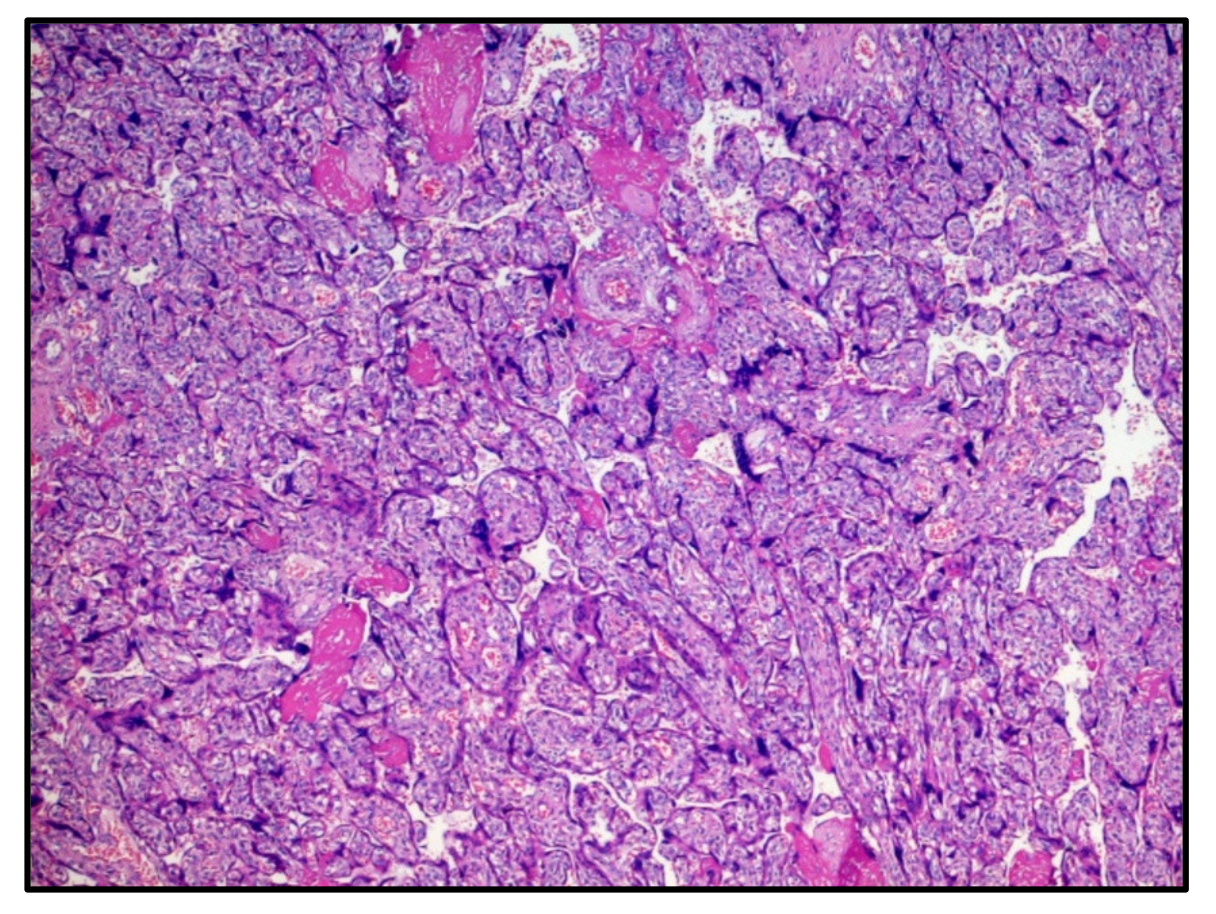 Viruses 13 00995 g001