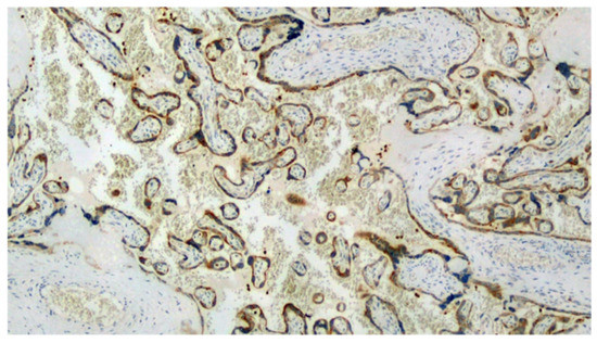 Viruses 13 00995 g002