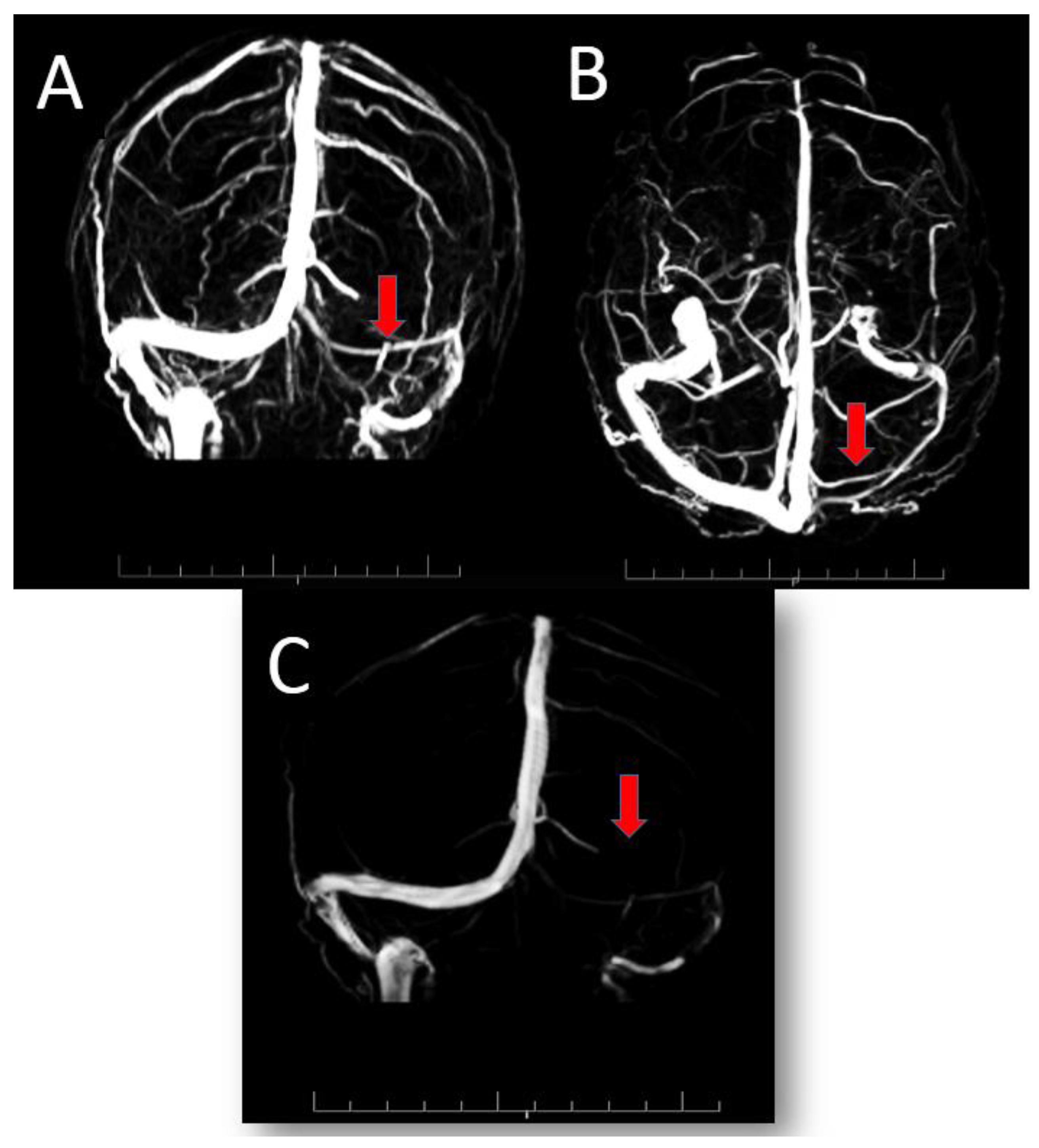 Viruses 13 01046 g001