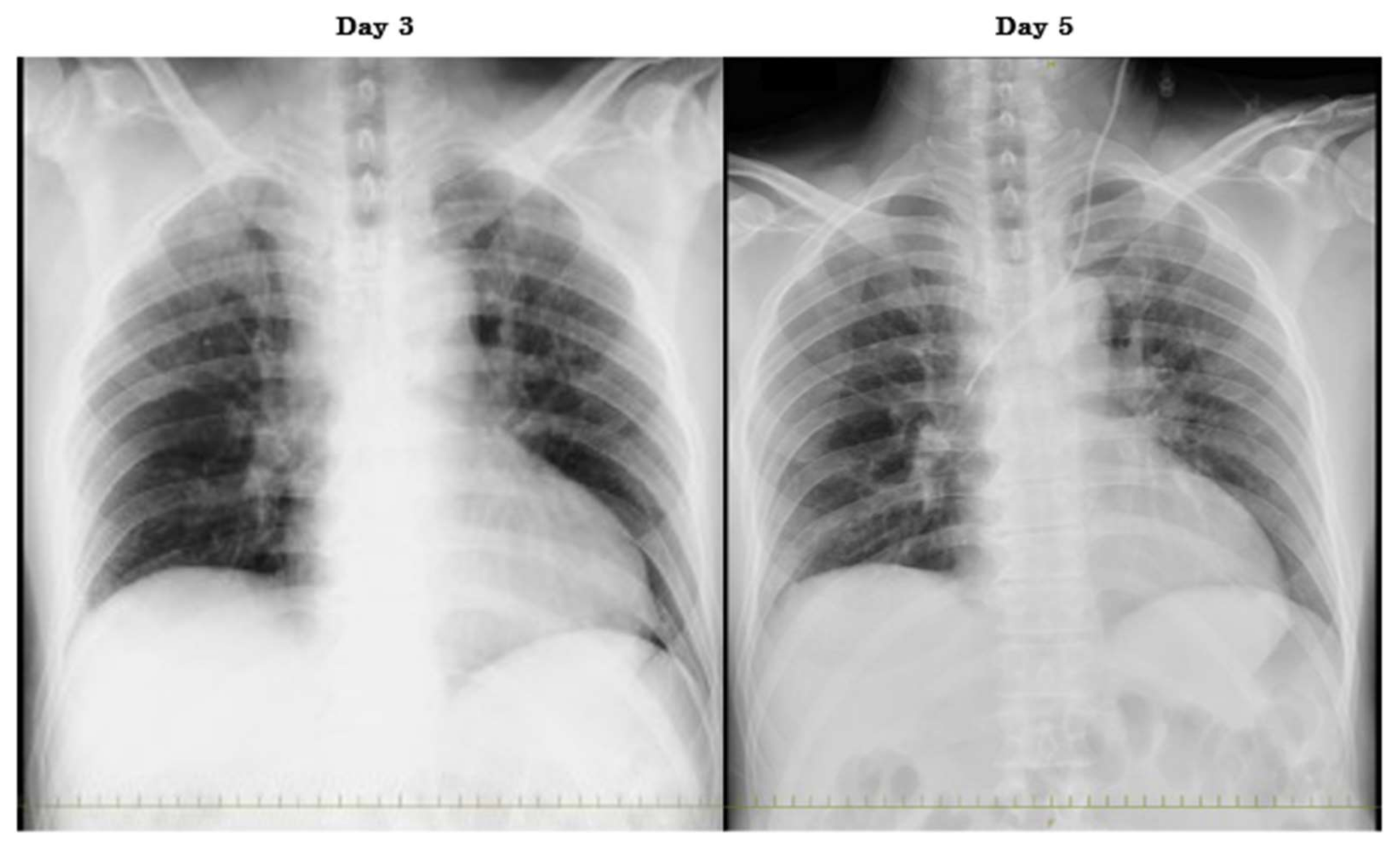 Viruses 13 01086 g001