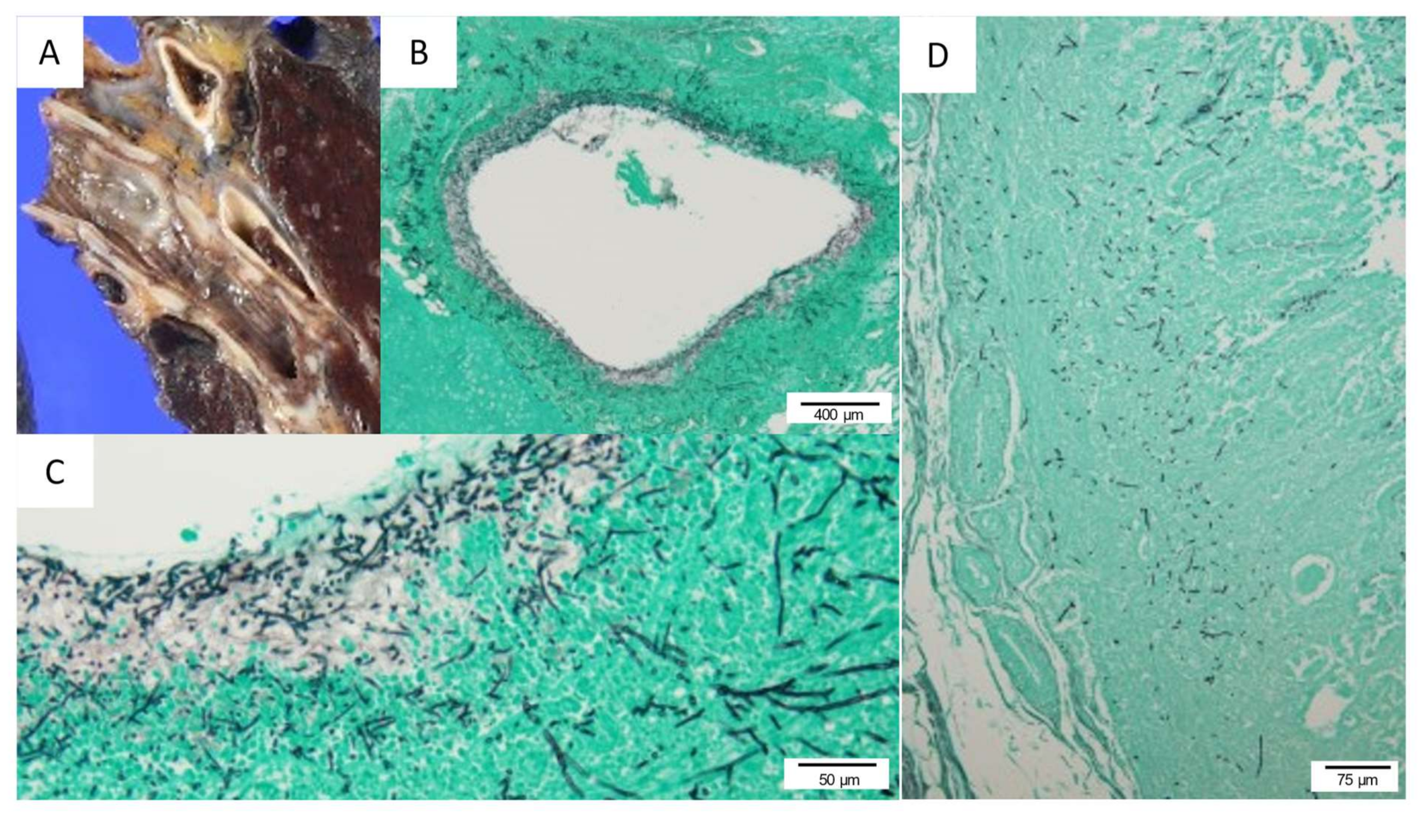 Viruses 13 01086 g005