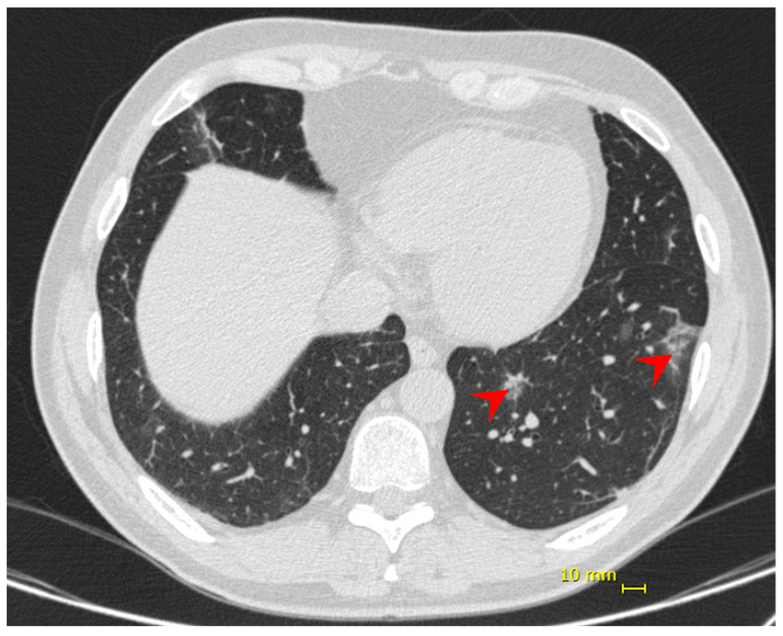 Viruses 13 01237 g002