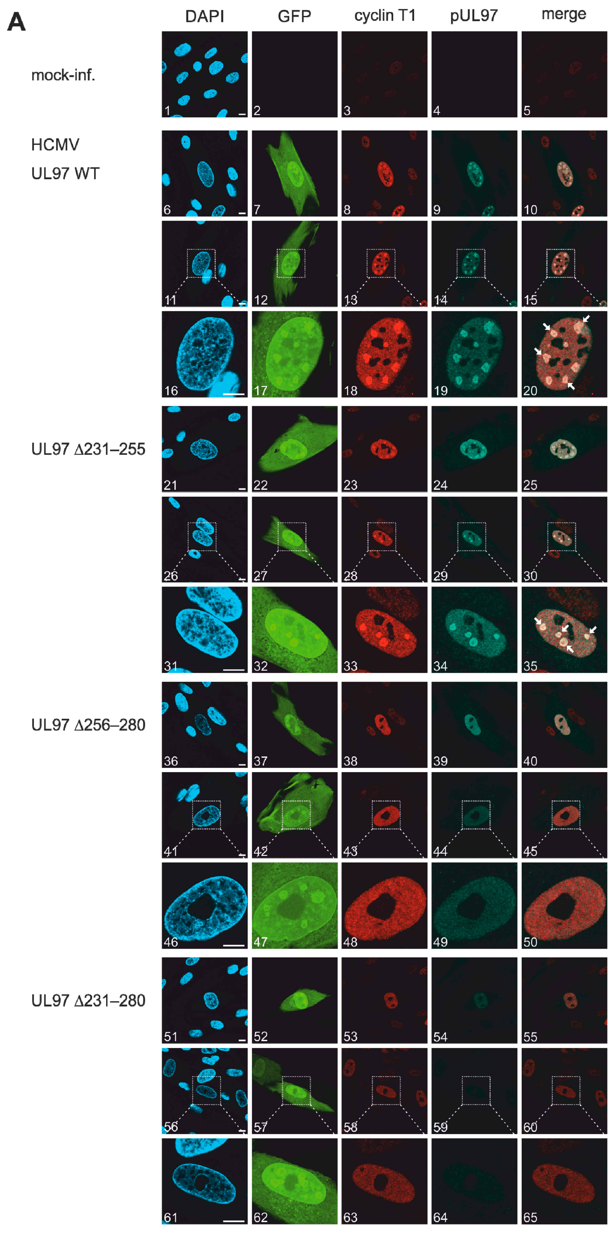 Viruses 13 01248 g005a