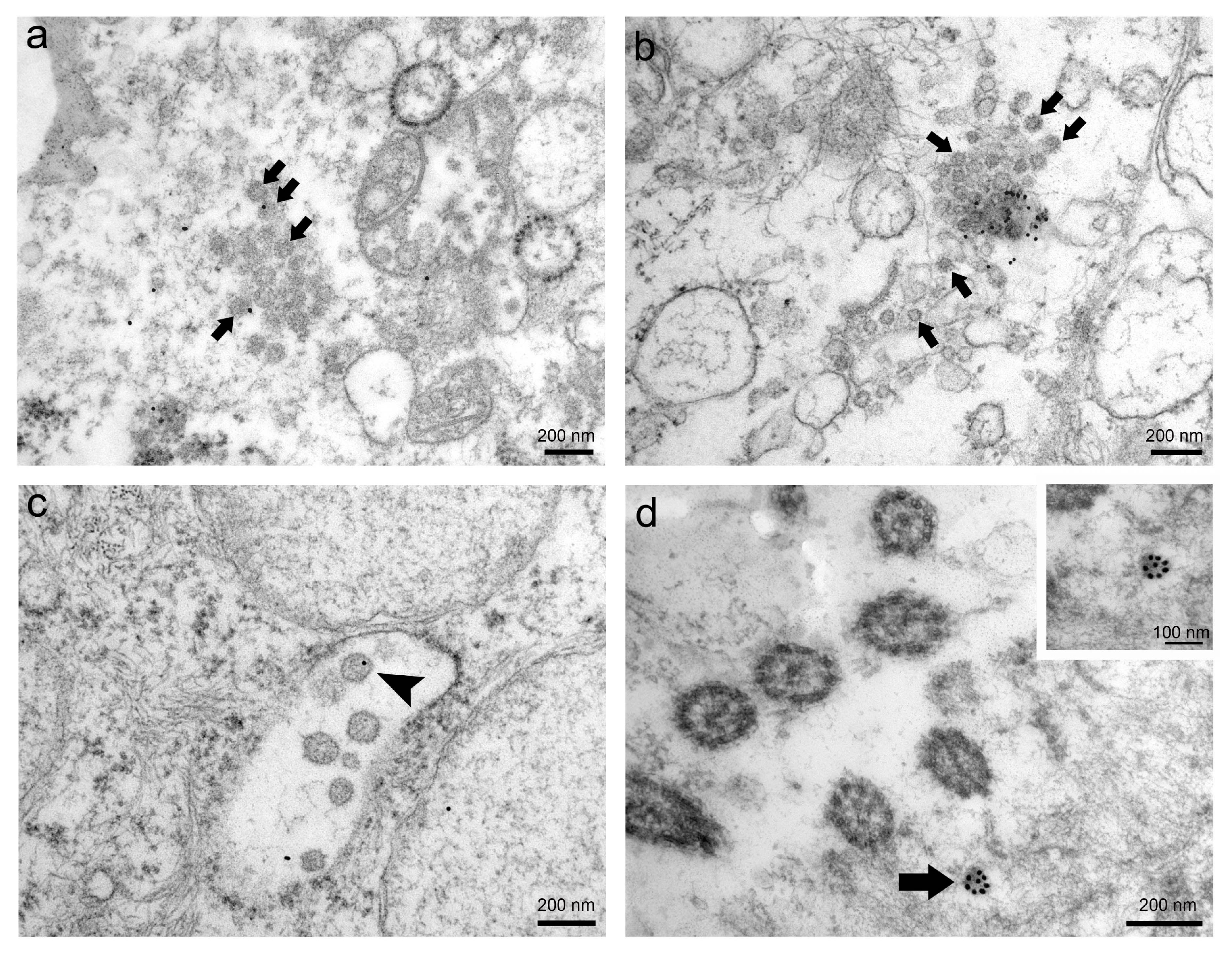 Viruses 13 01816 g003 Viruses 13 01816 g003