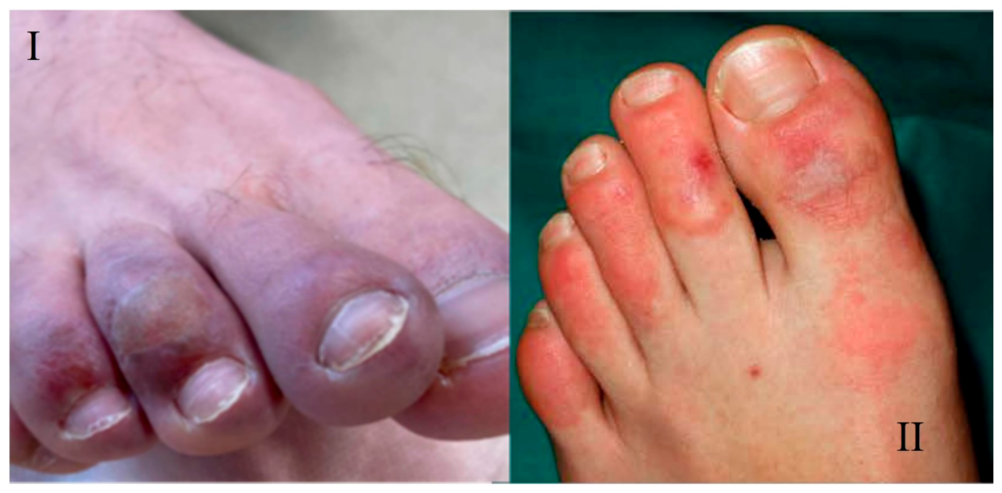 Viruses 13 01916 g004