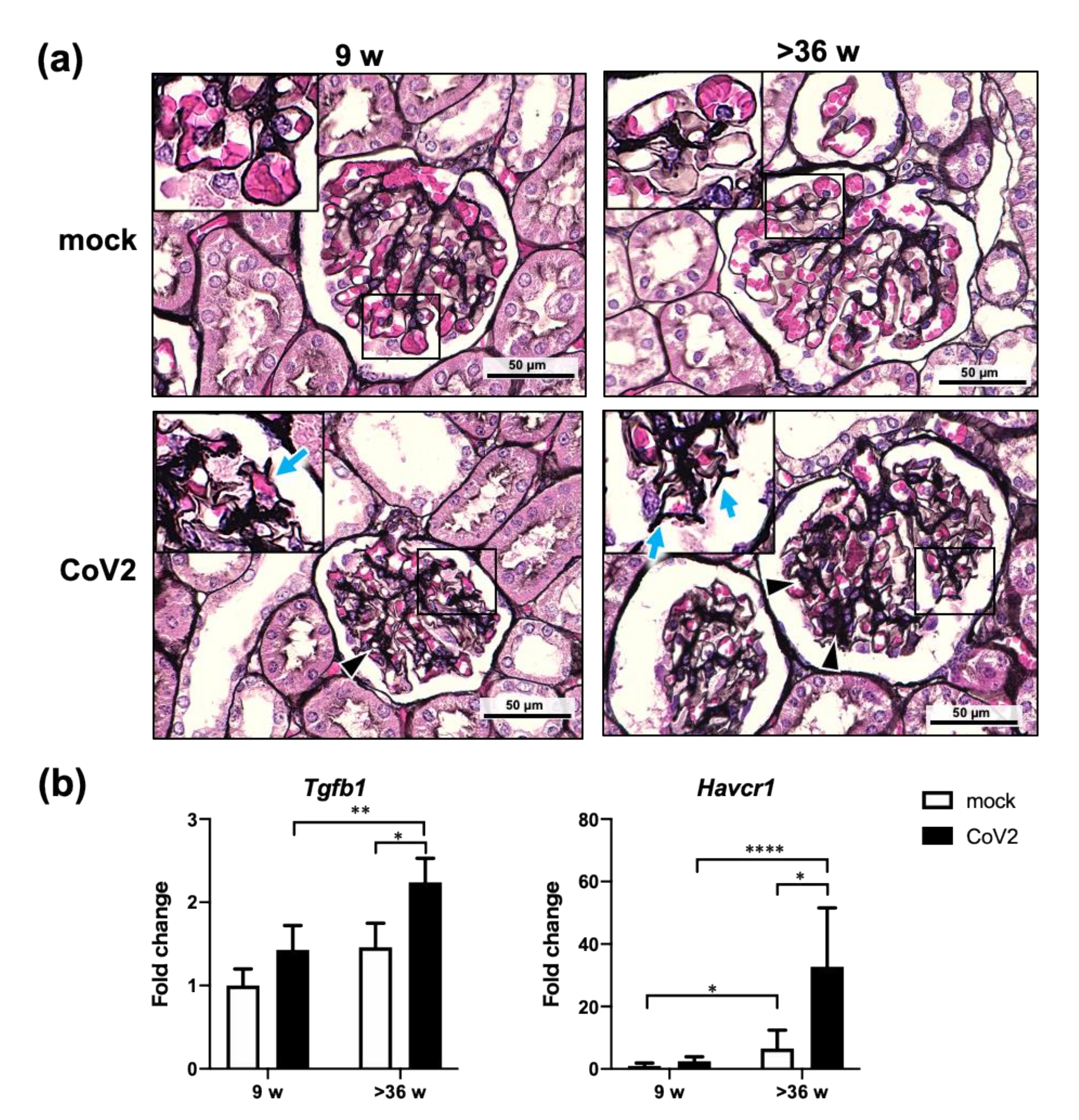 Viruses 13 02137 g005