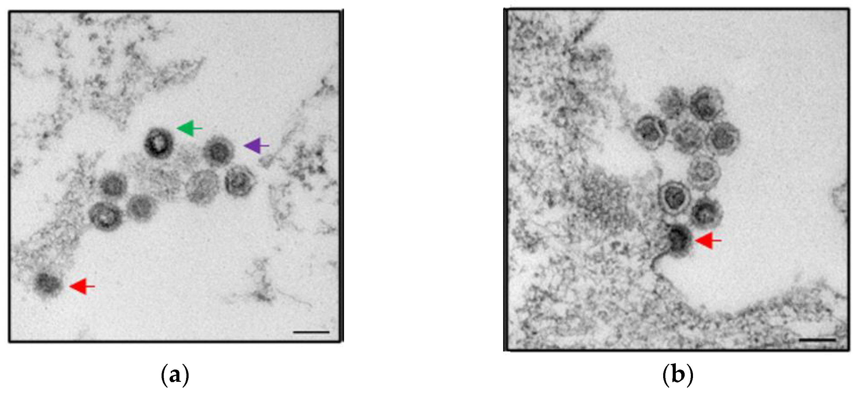 Viruses 13 02156 g003