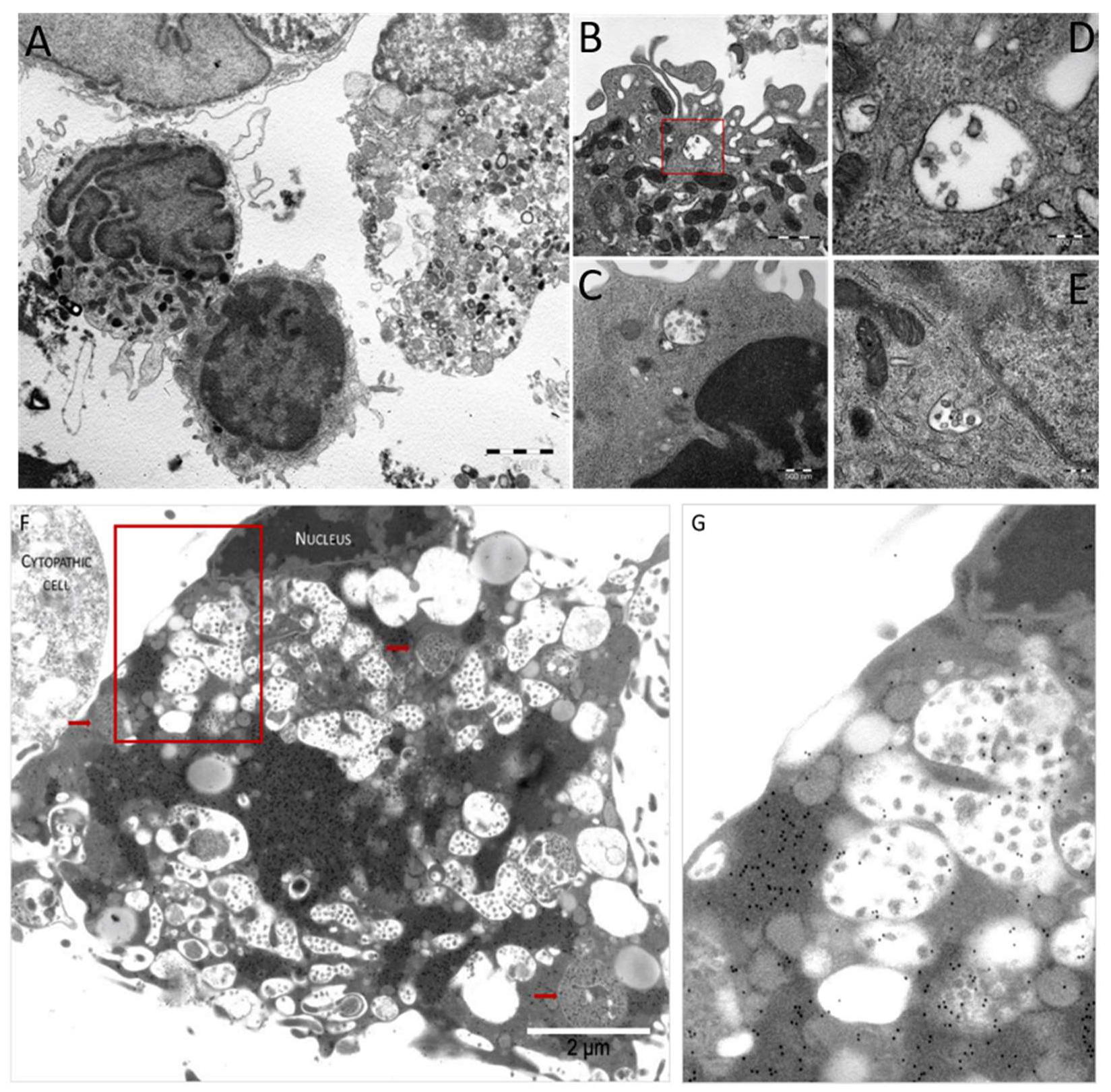 Viruses 13 02178 g008