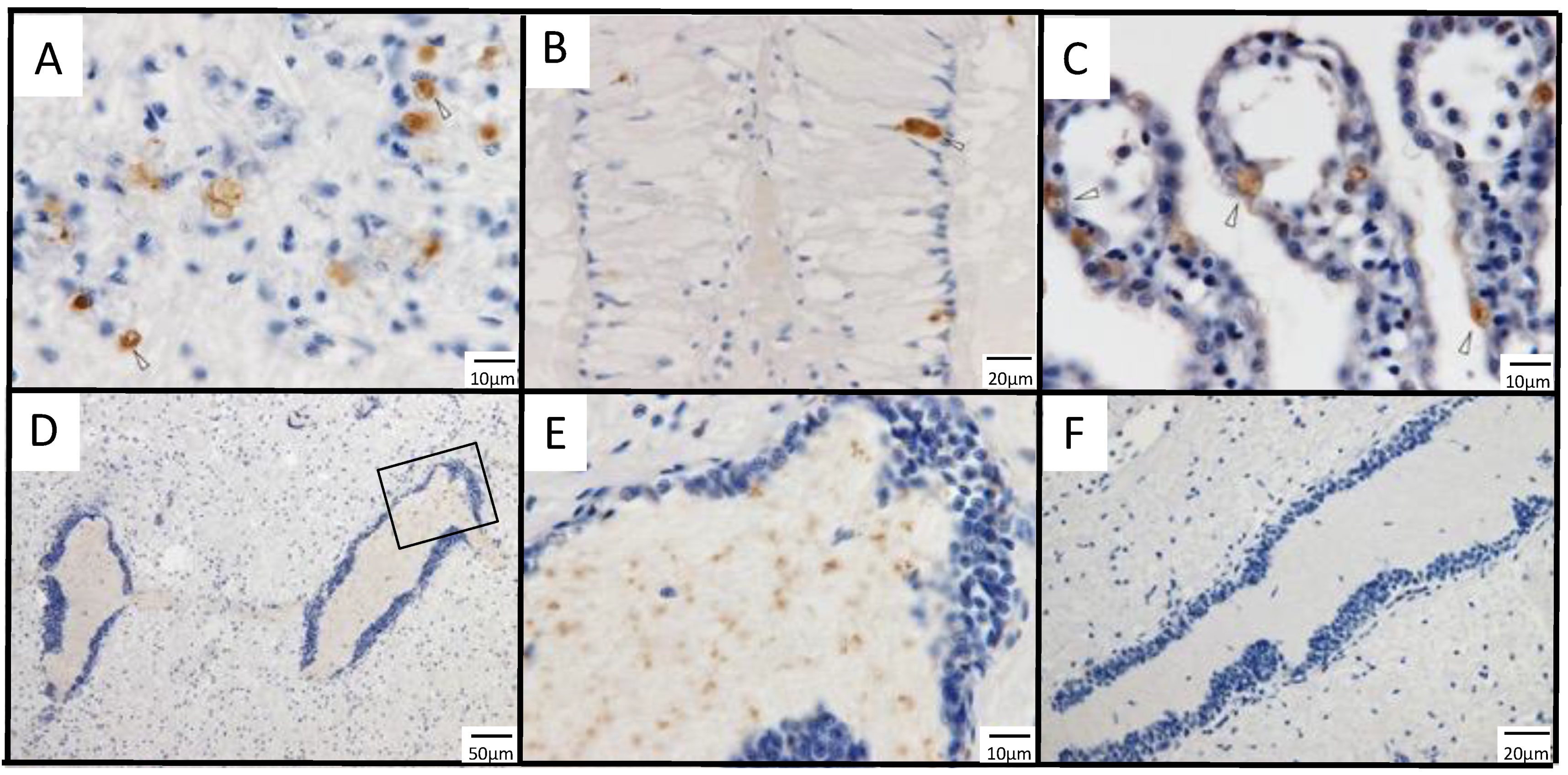 Viruses 13 02315 g006