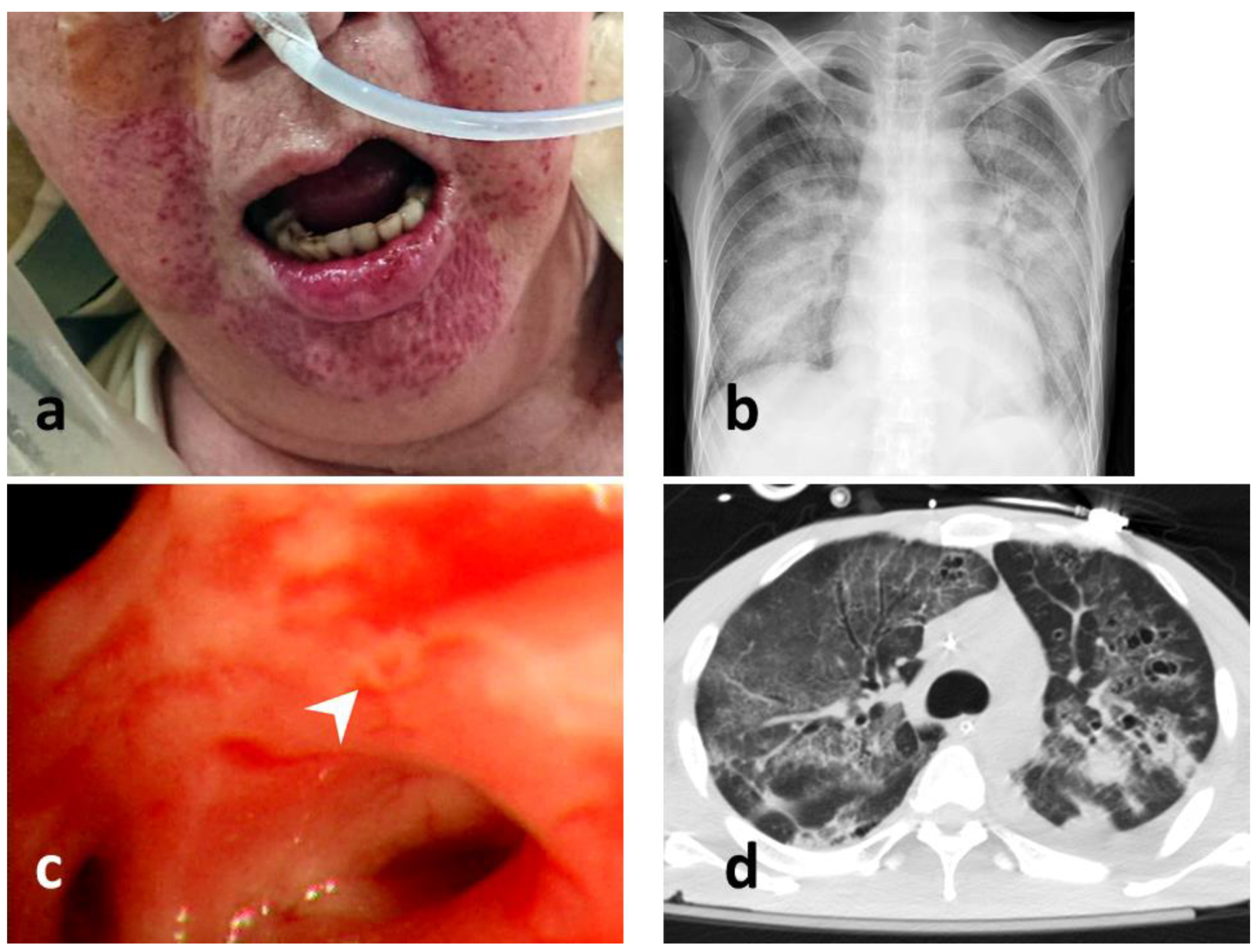 Viruses 14 00205 g002