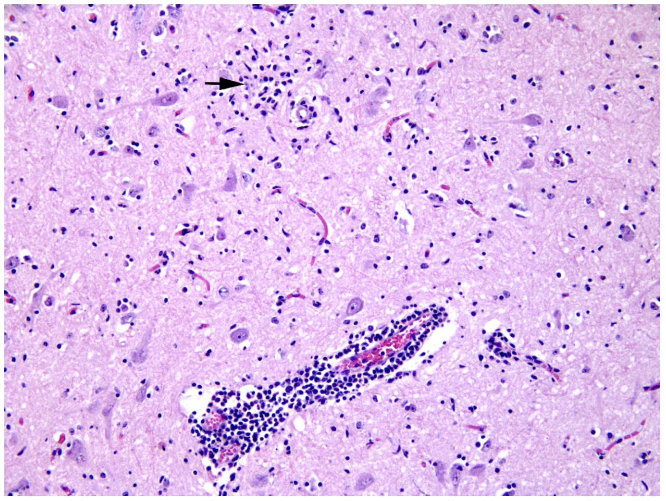 Viruses 14 00300 g002