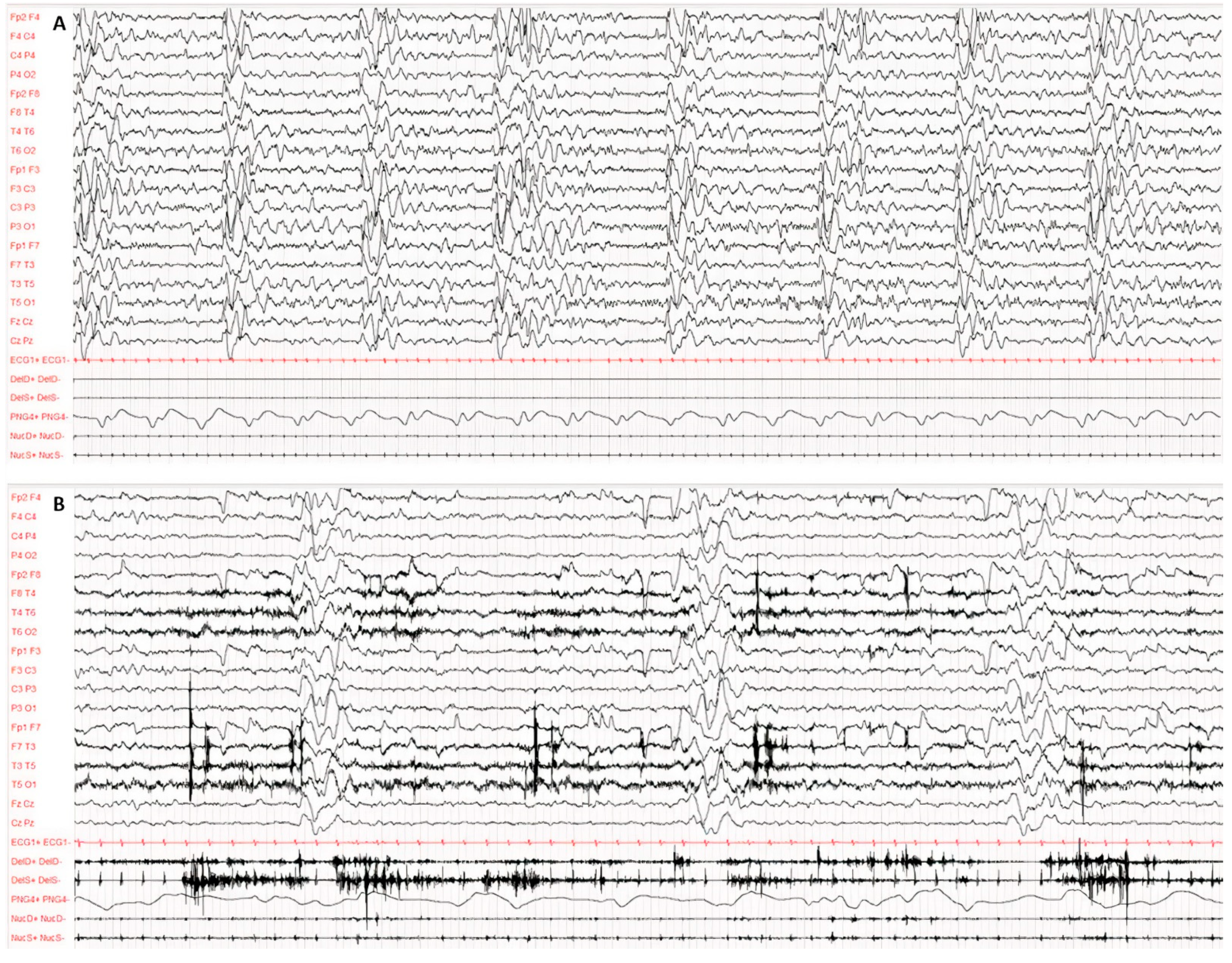 Viruses 14 00733 g001