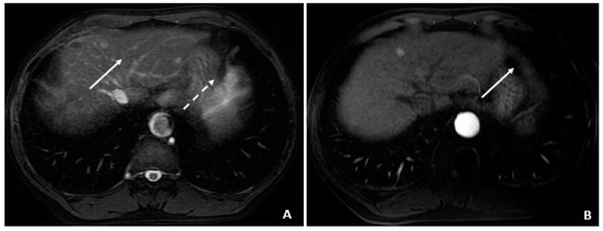 Viruses 14 00775 g004 550