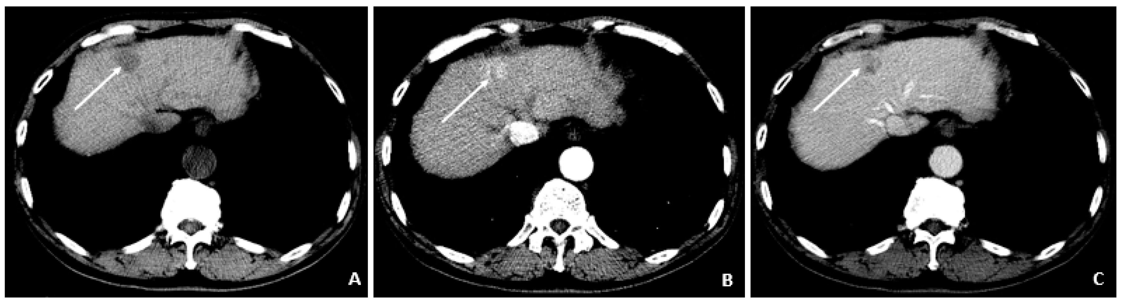 Viruses 14 00775 g005