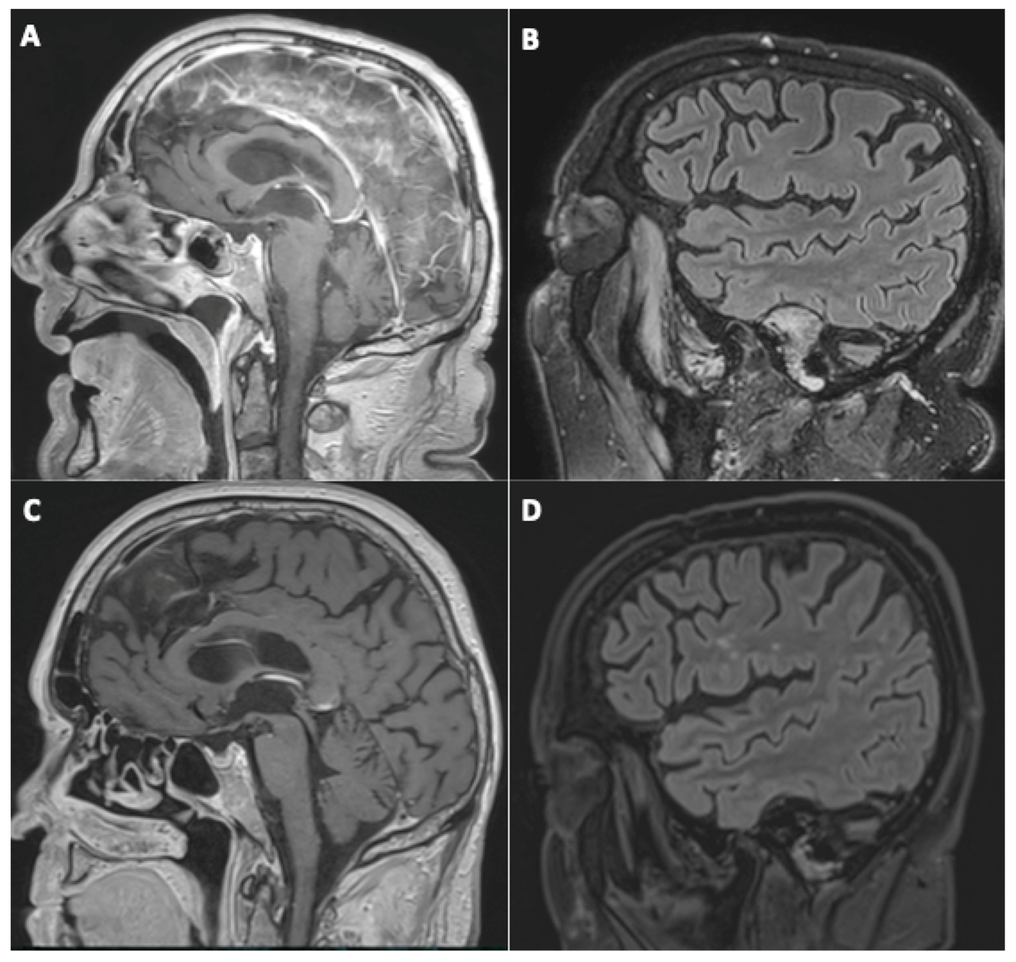 Viruses 14 00949 g002