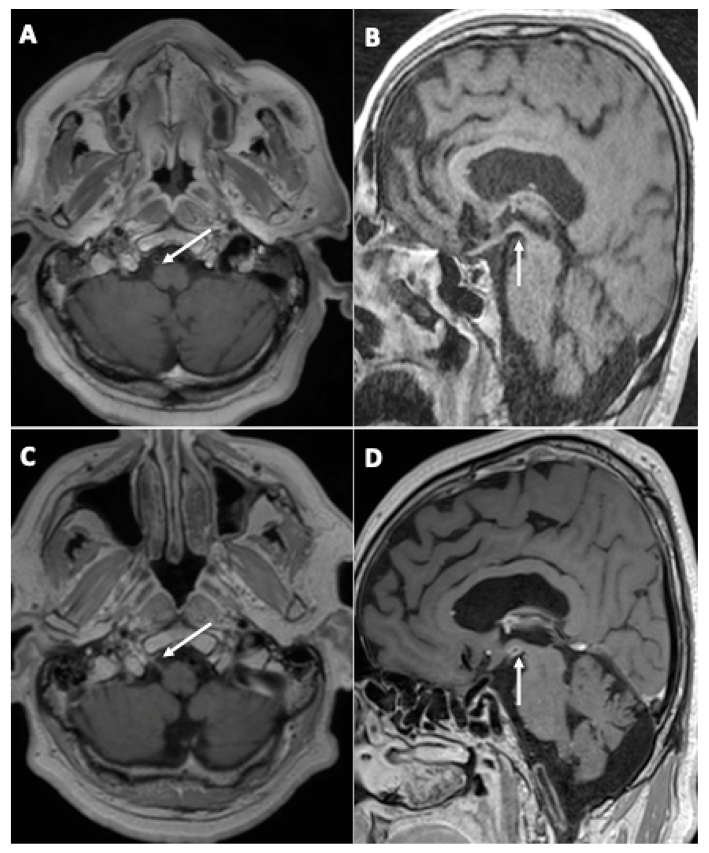 Viruses 14 00949 g003