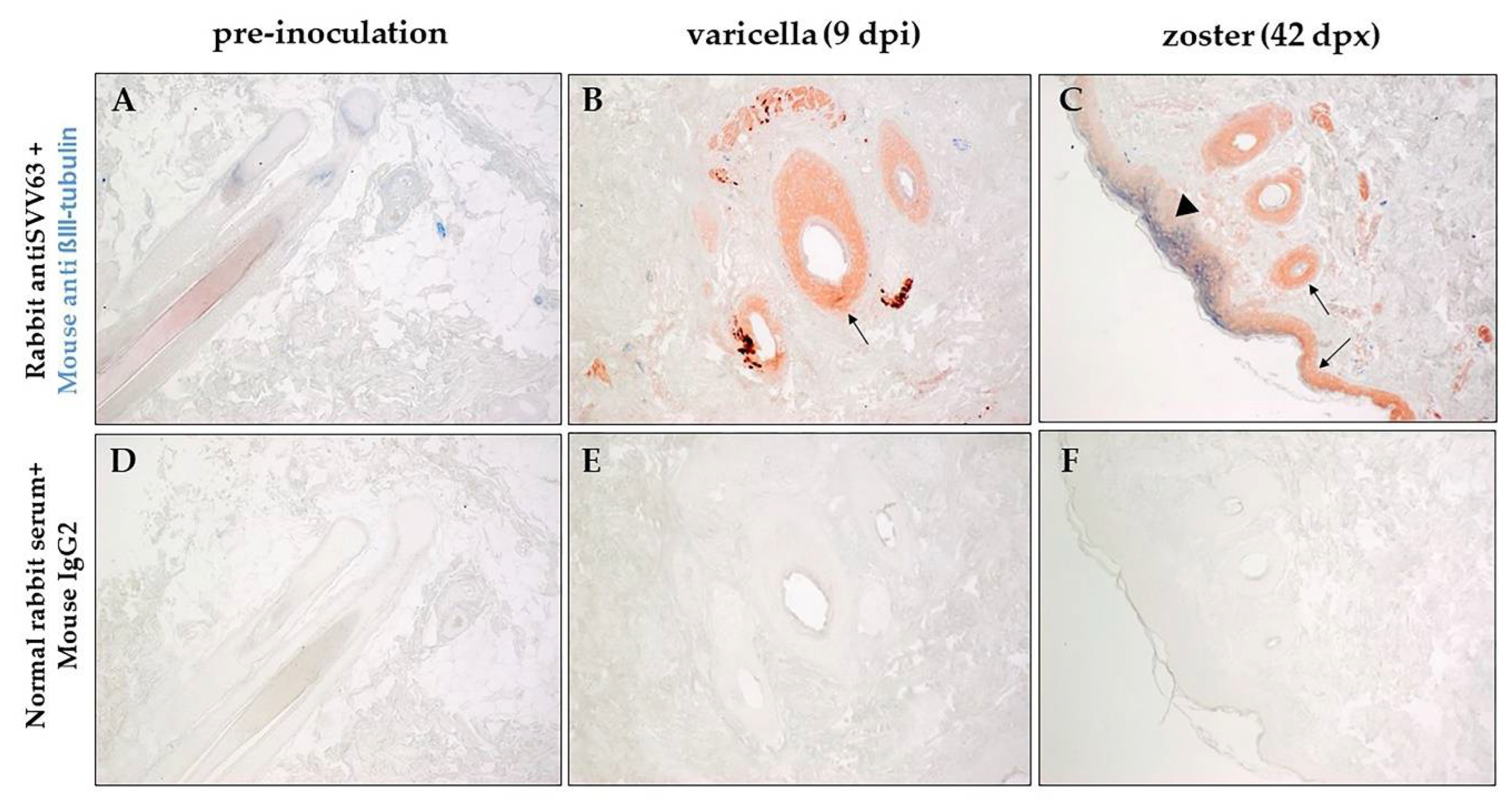 Viruses 14 01167 g003