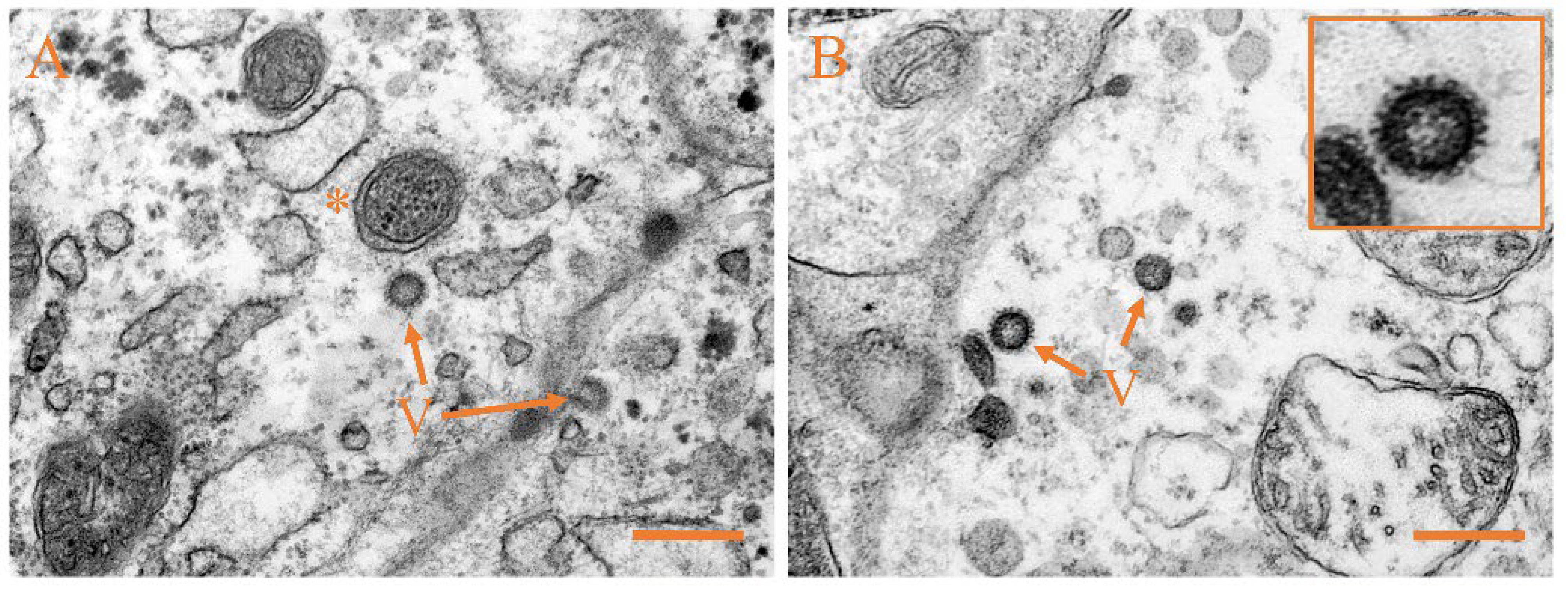 Viruses 14 01216 g005a