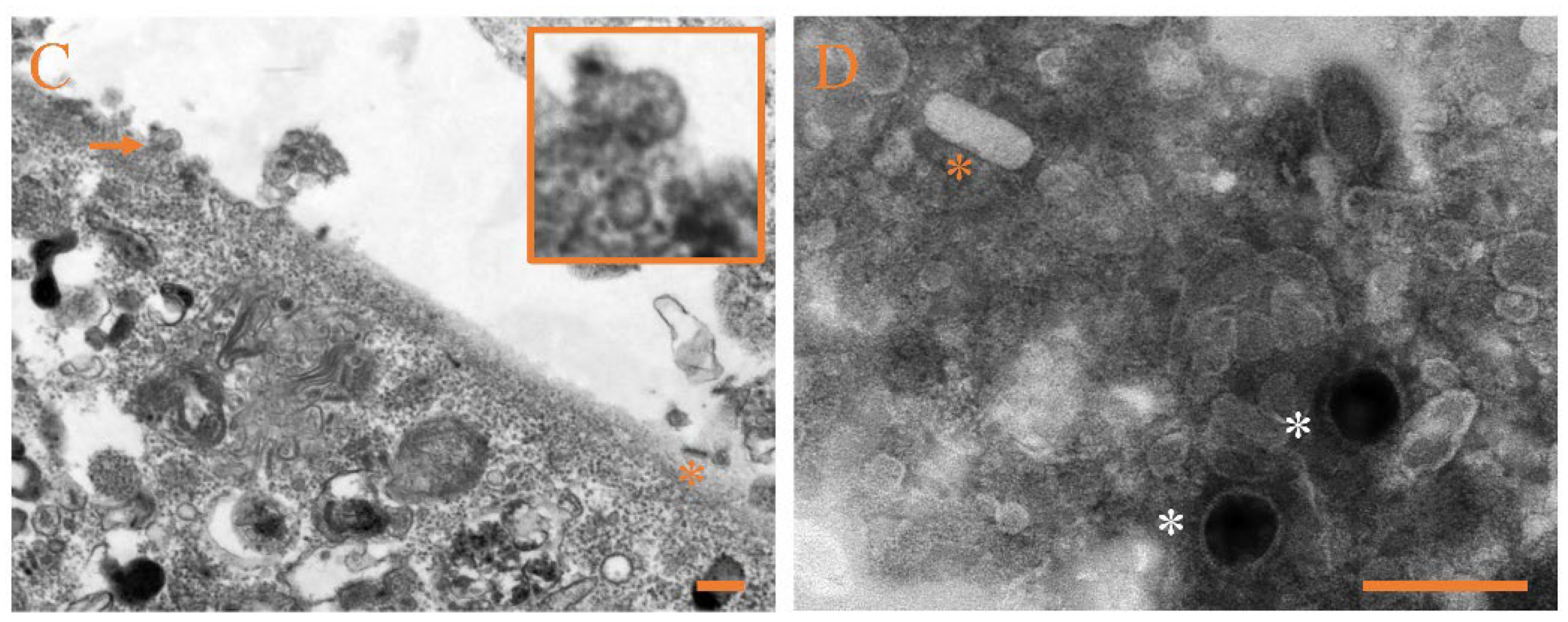 Viruses 14 01216 g006b