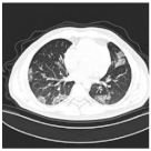 Viruses 14 01667 i002