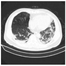 Viruses 14 01667 i005