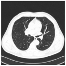 Viruses 14 01667 i009