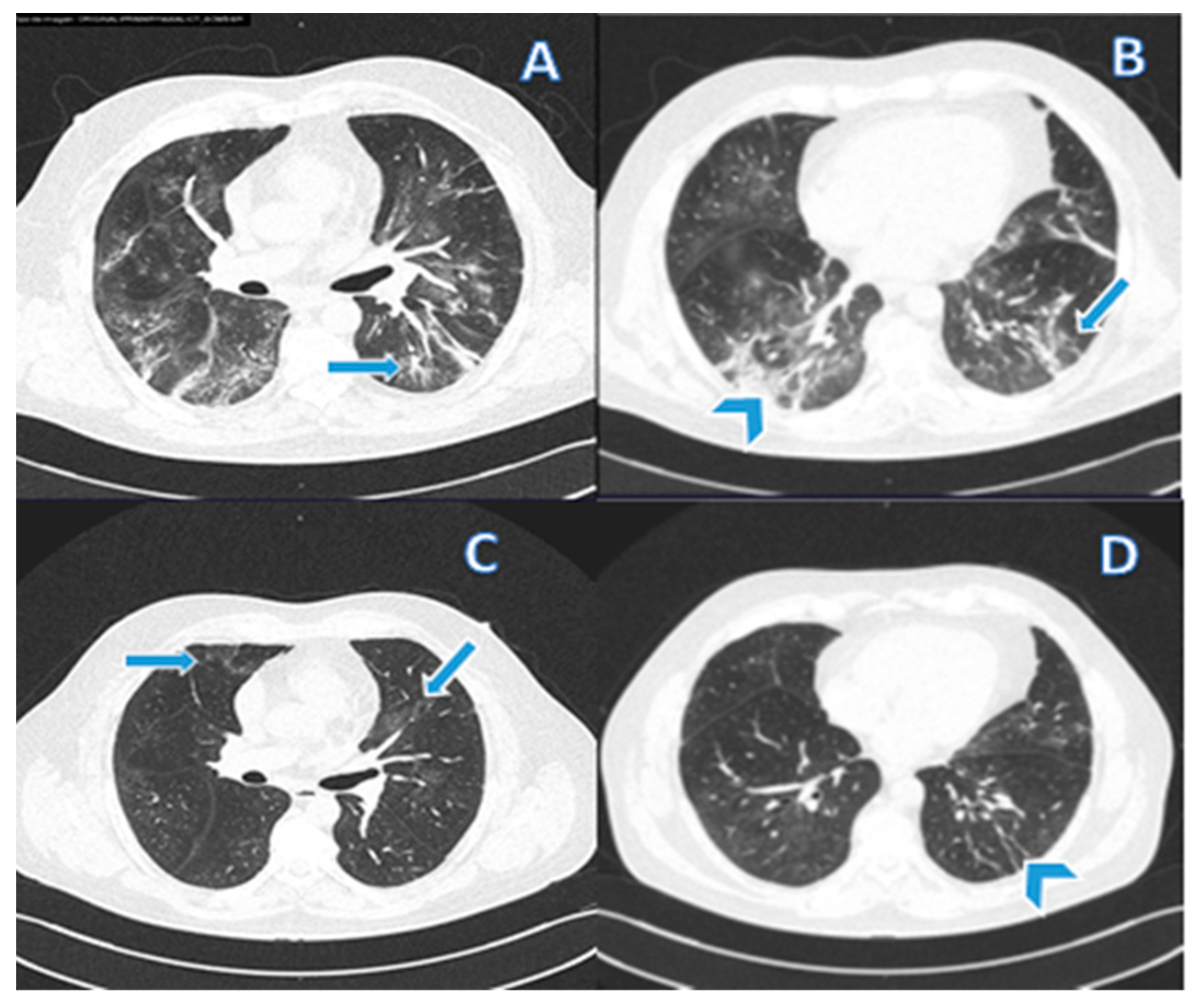 Viruses 14 01843 g003