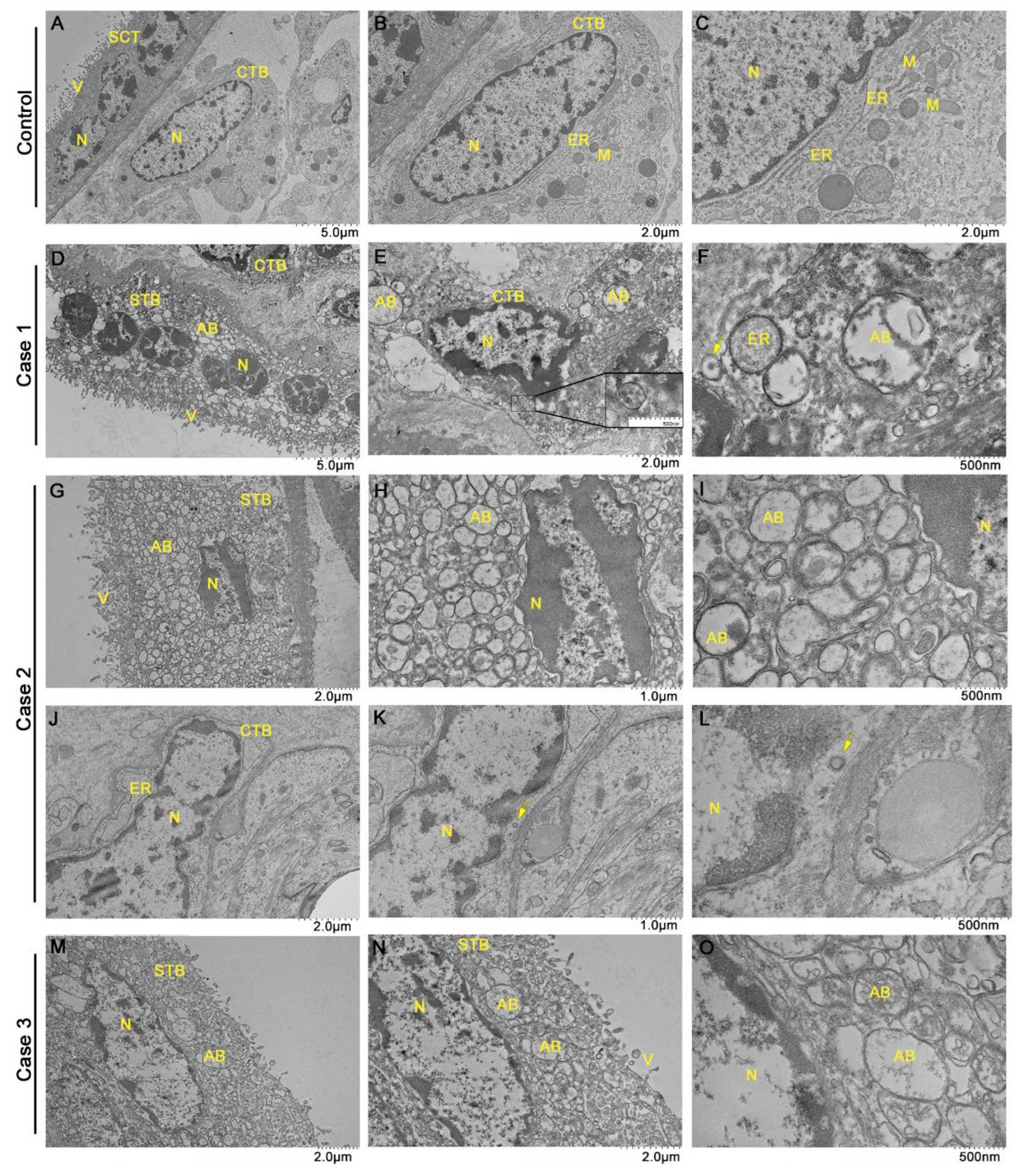 Viruses 14 01885 g004