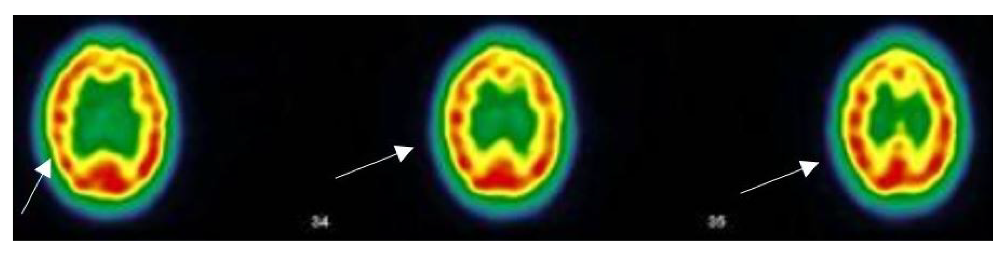 Viruses 14 02000 g003