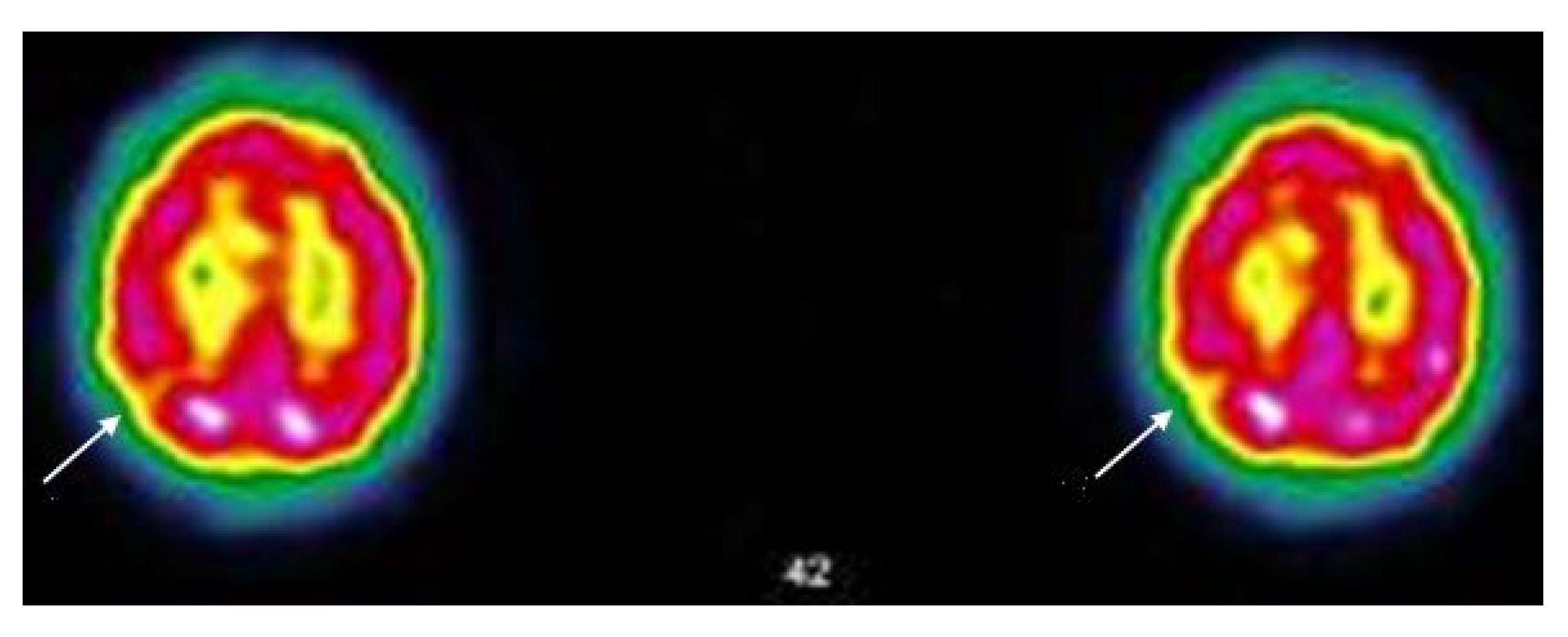 Viruses 14 02000 g005