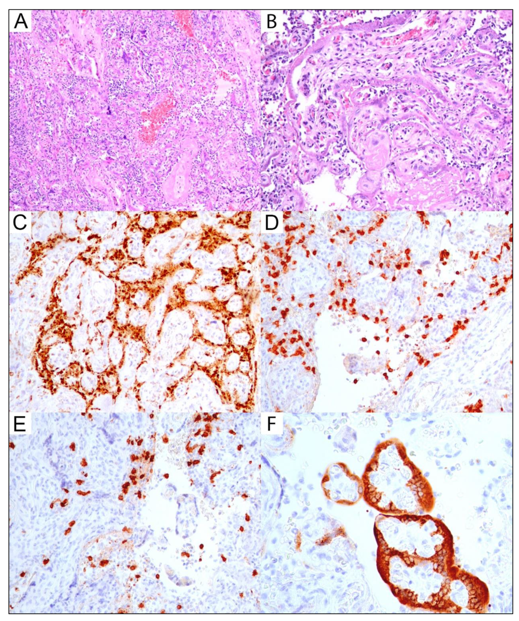 Viruses 14 02043 g002