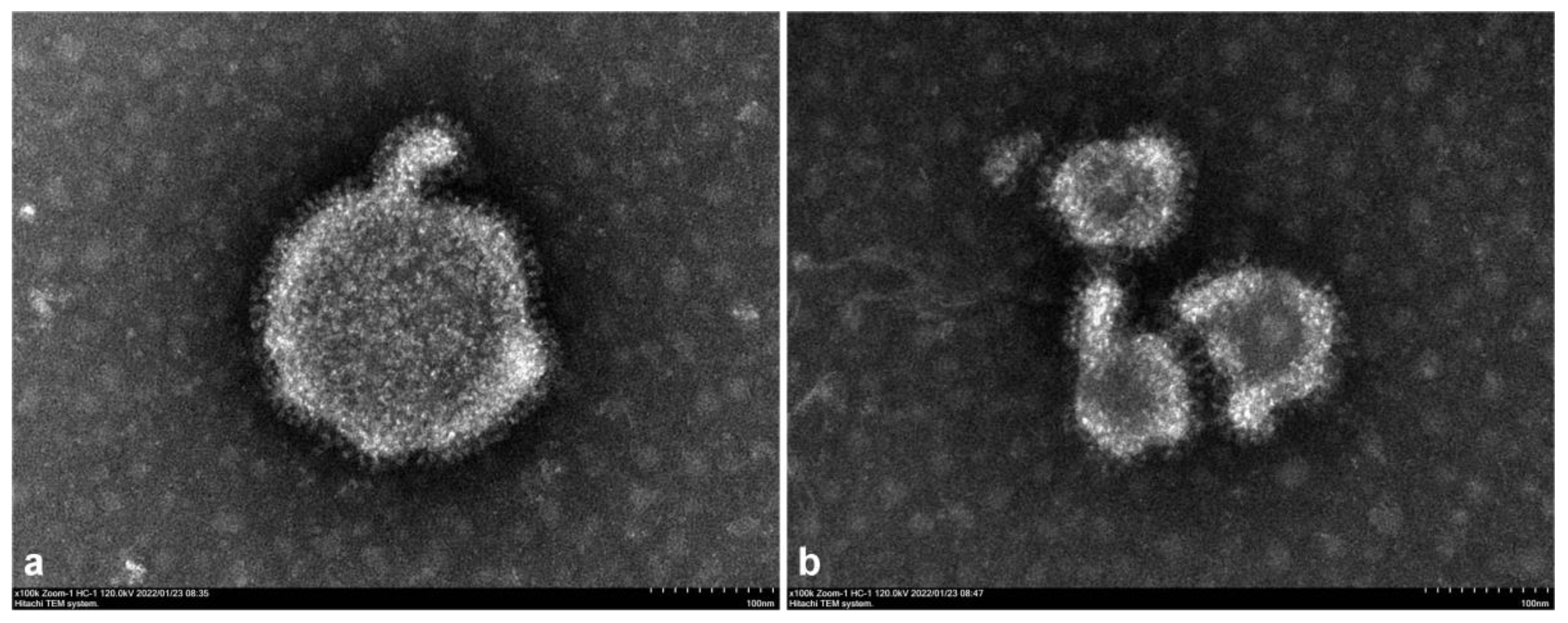 Viruses 14 02221 g003